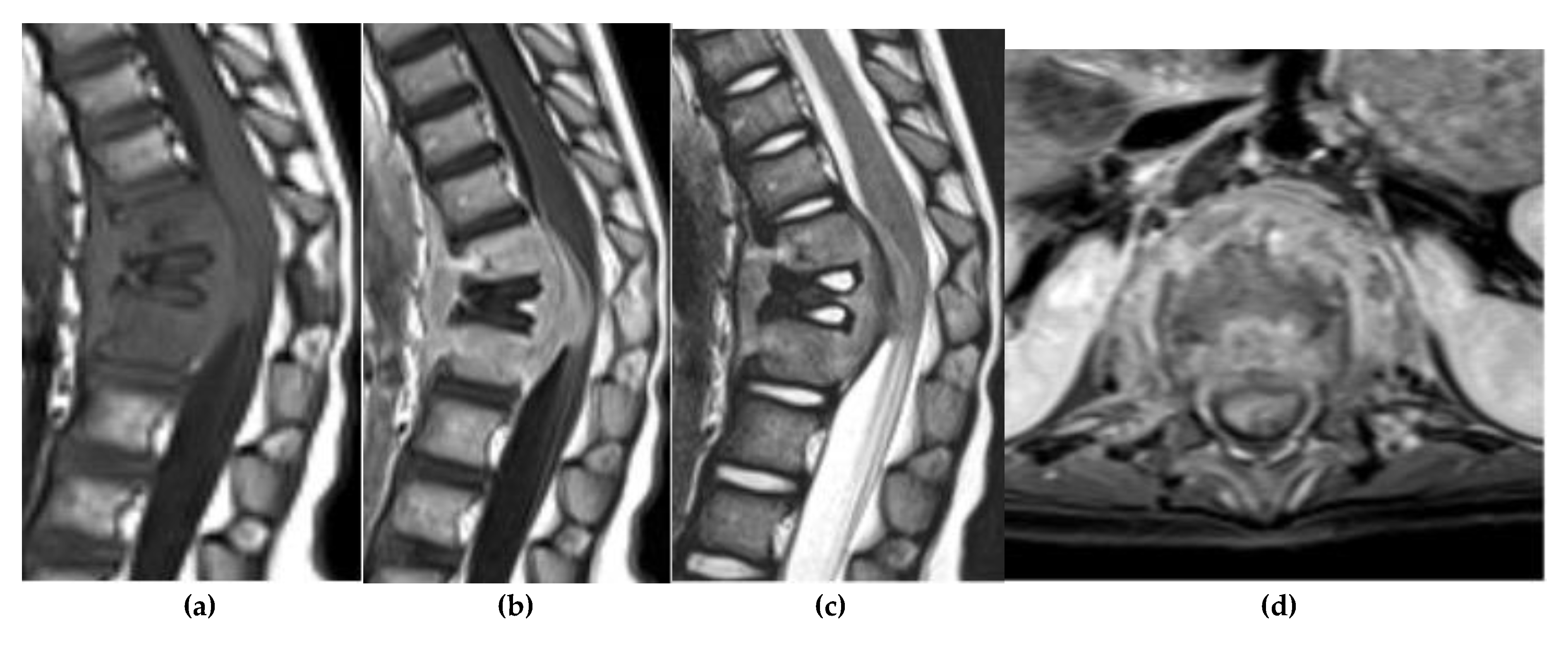 Preprints 180579 g025