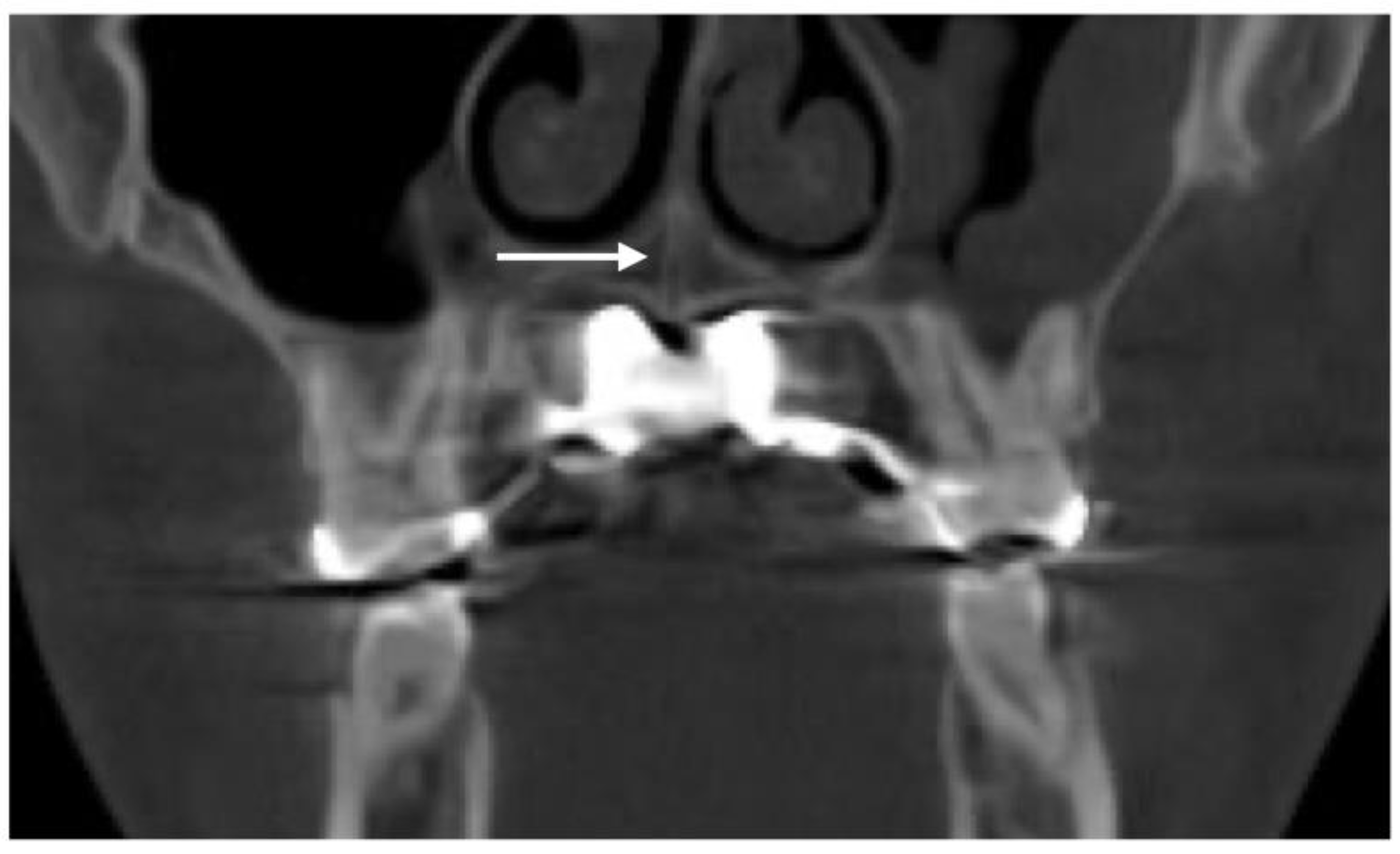 Preprints 178789 g002