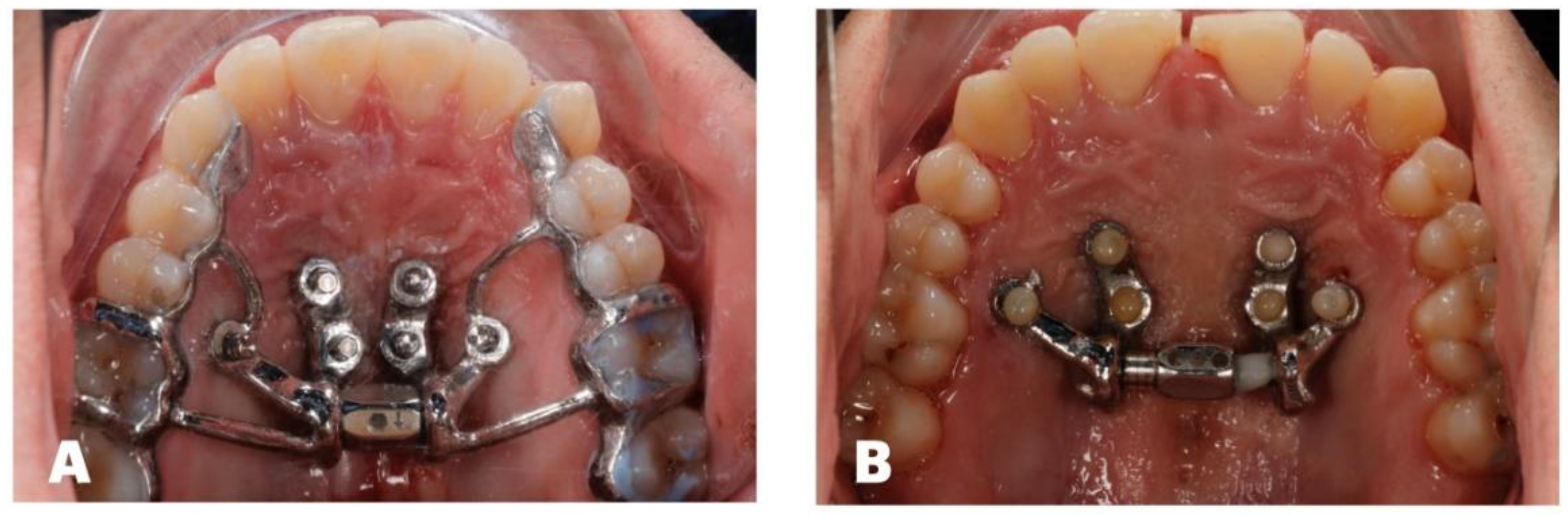 Preprints 178789 g003