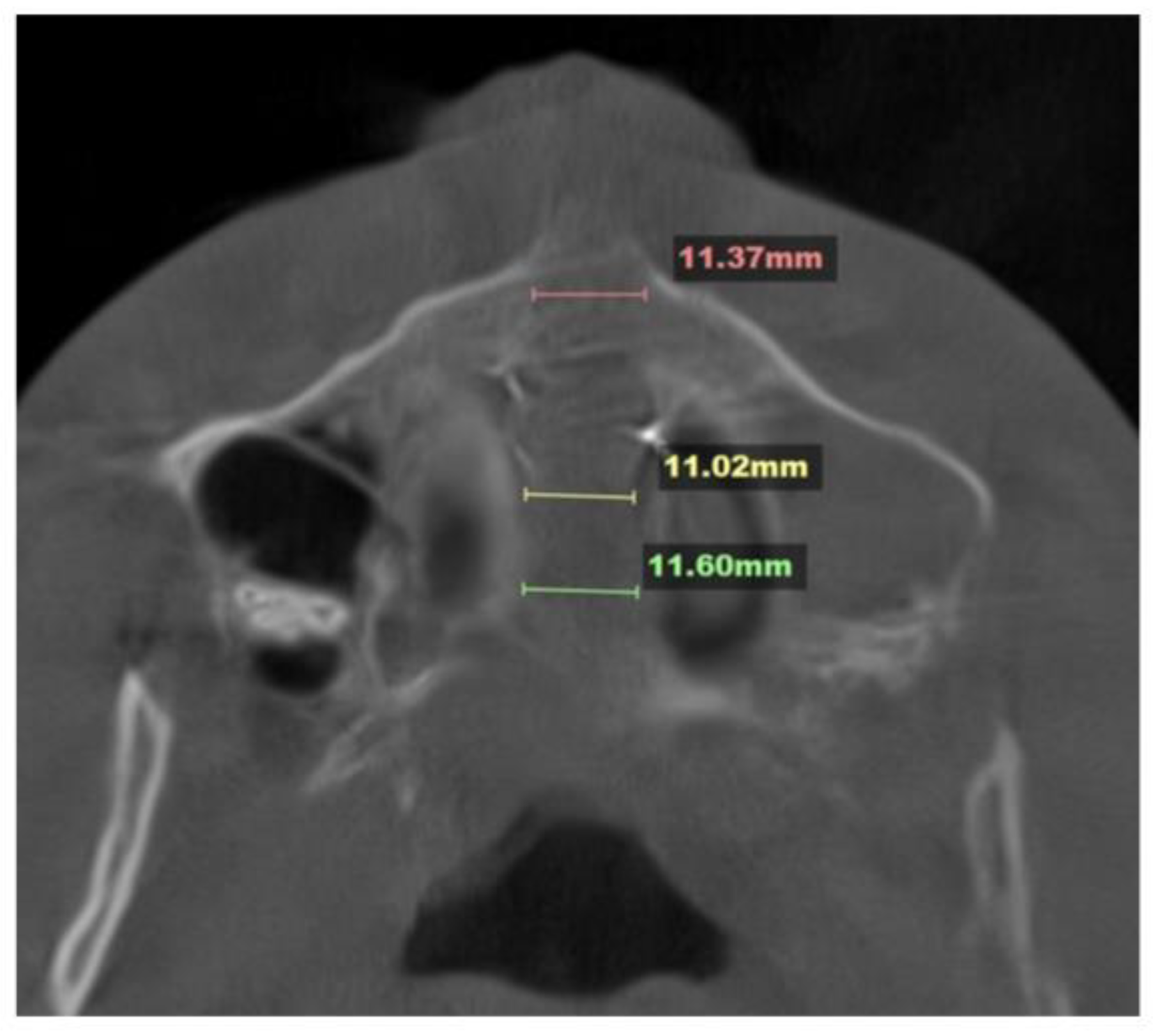 Preprints 178789 g004