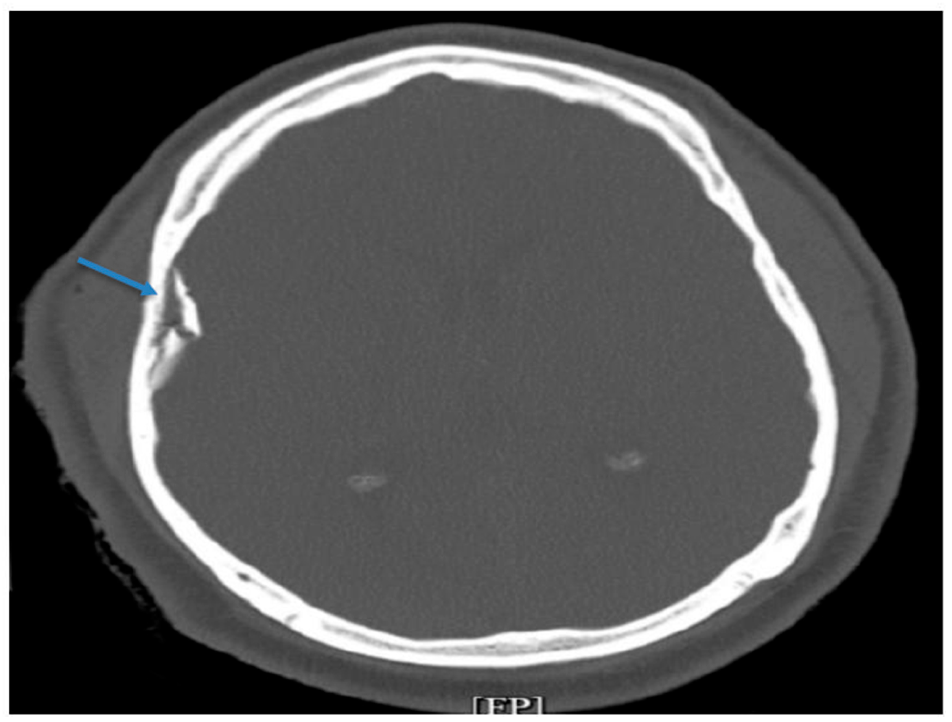 Preprints 184408 g001
