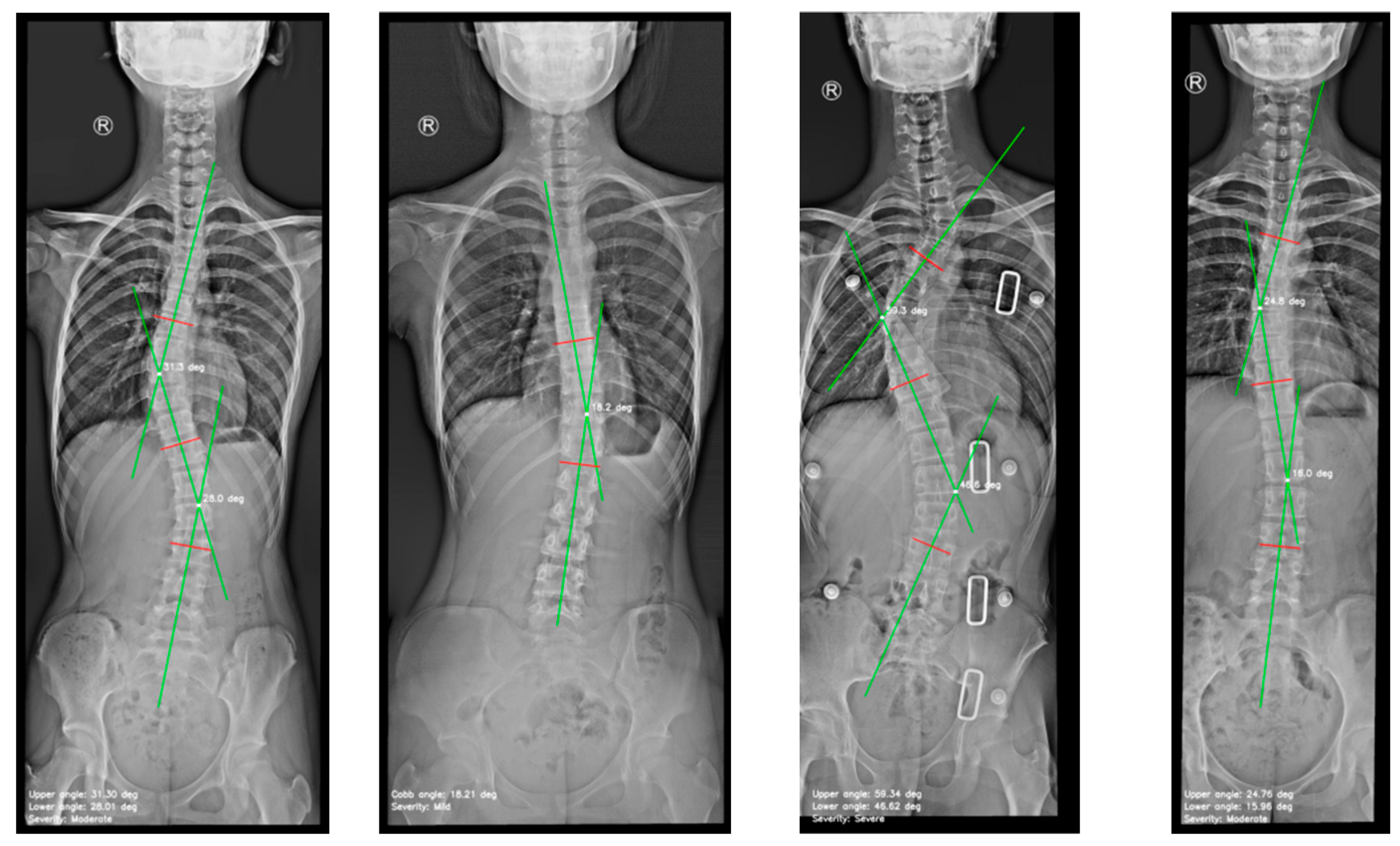 Preprints 152195 g009b