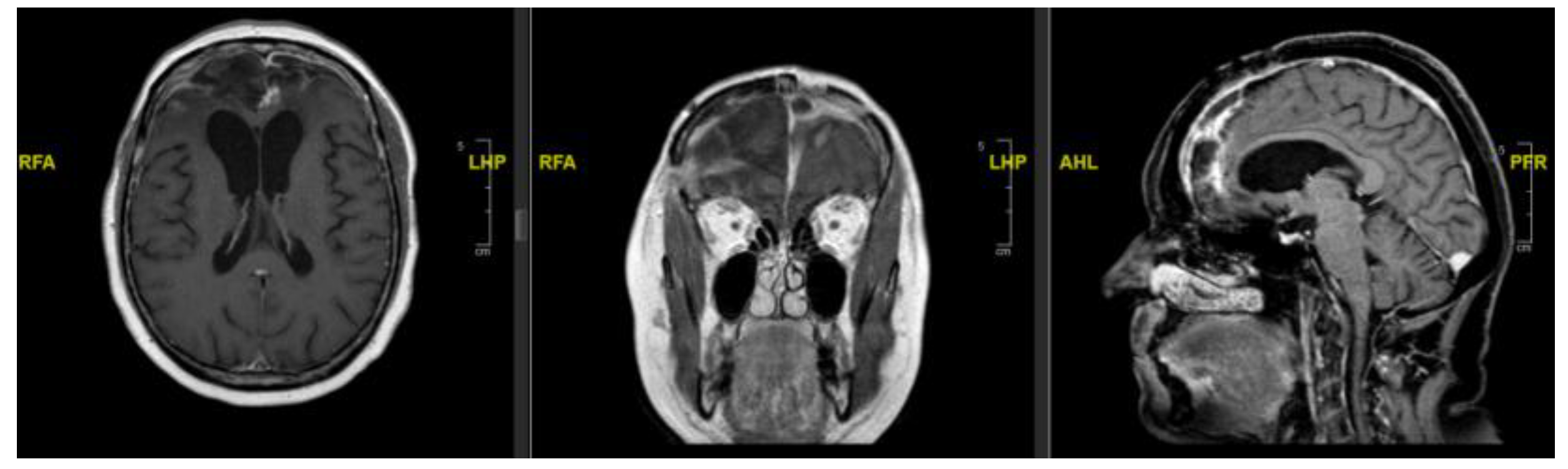 Preprints 209767 g003