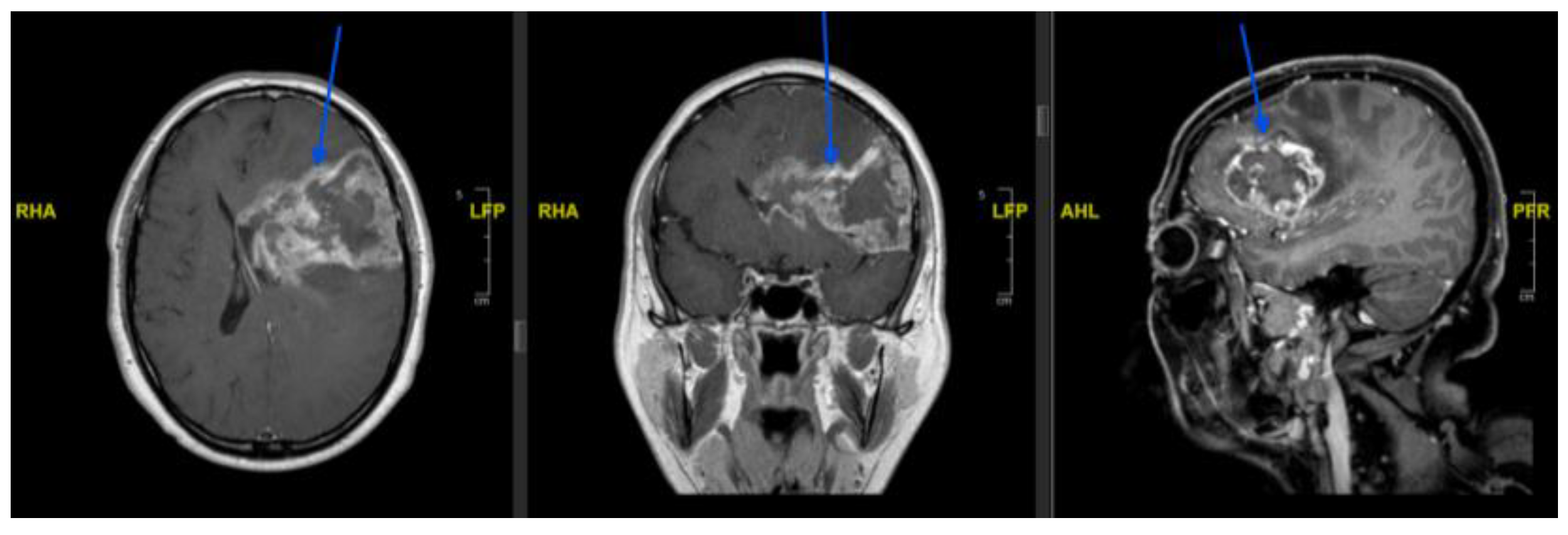 Preprints 209767 g004