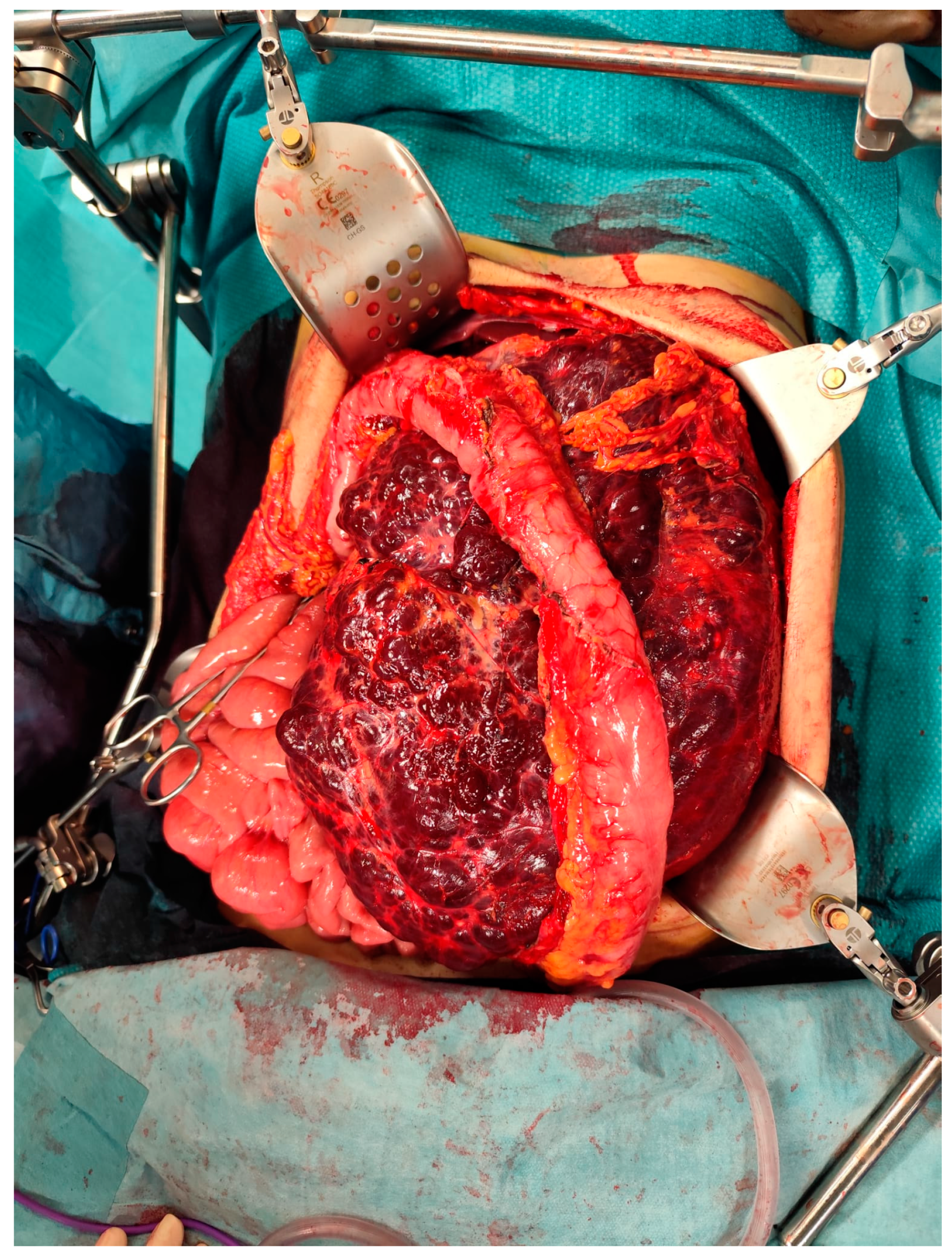 Preprints 169409 g004