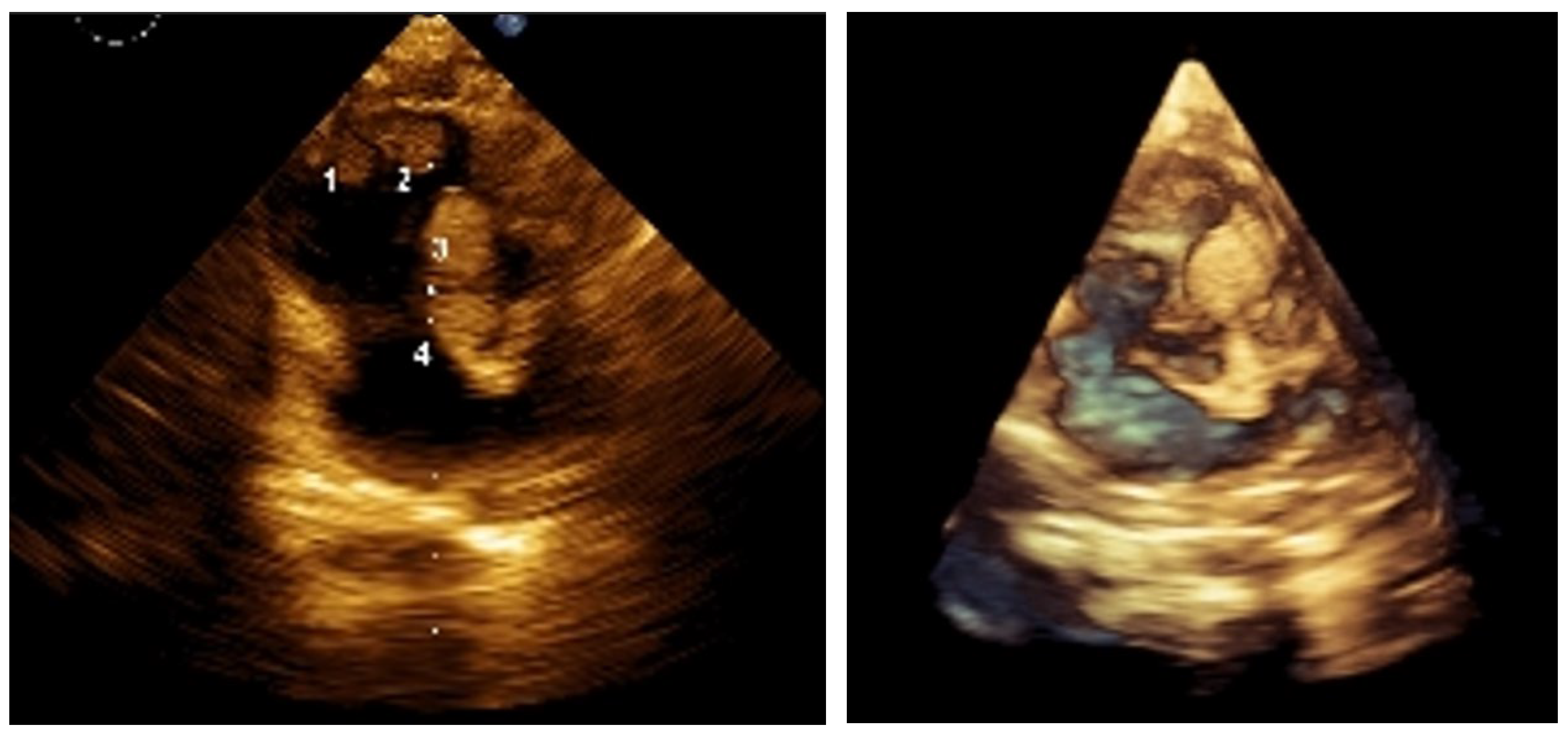 Preprints 171385 g001