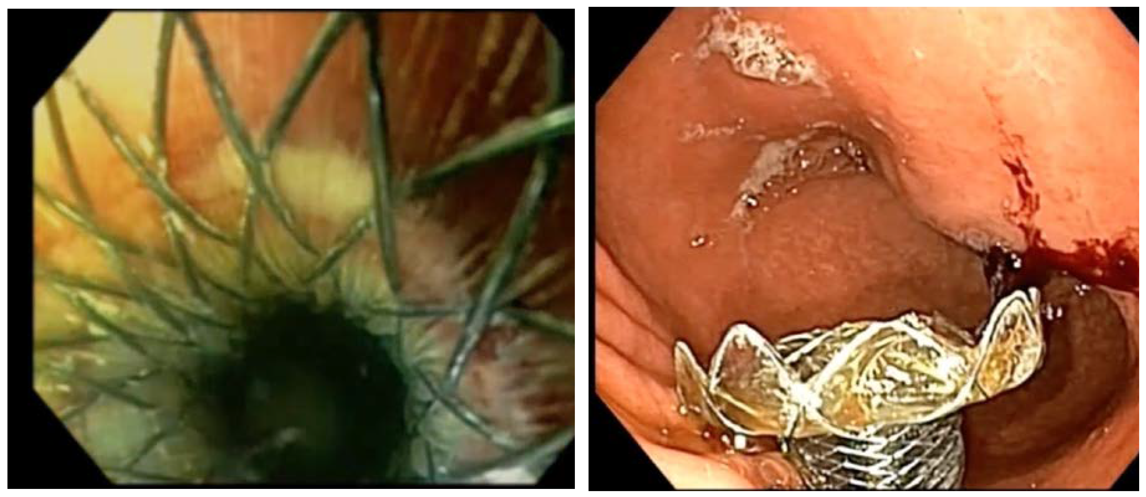 Preprints 93746 g001b