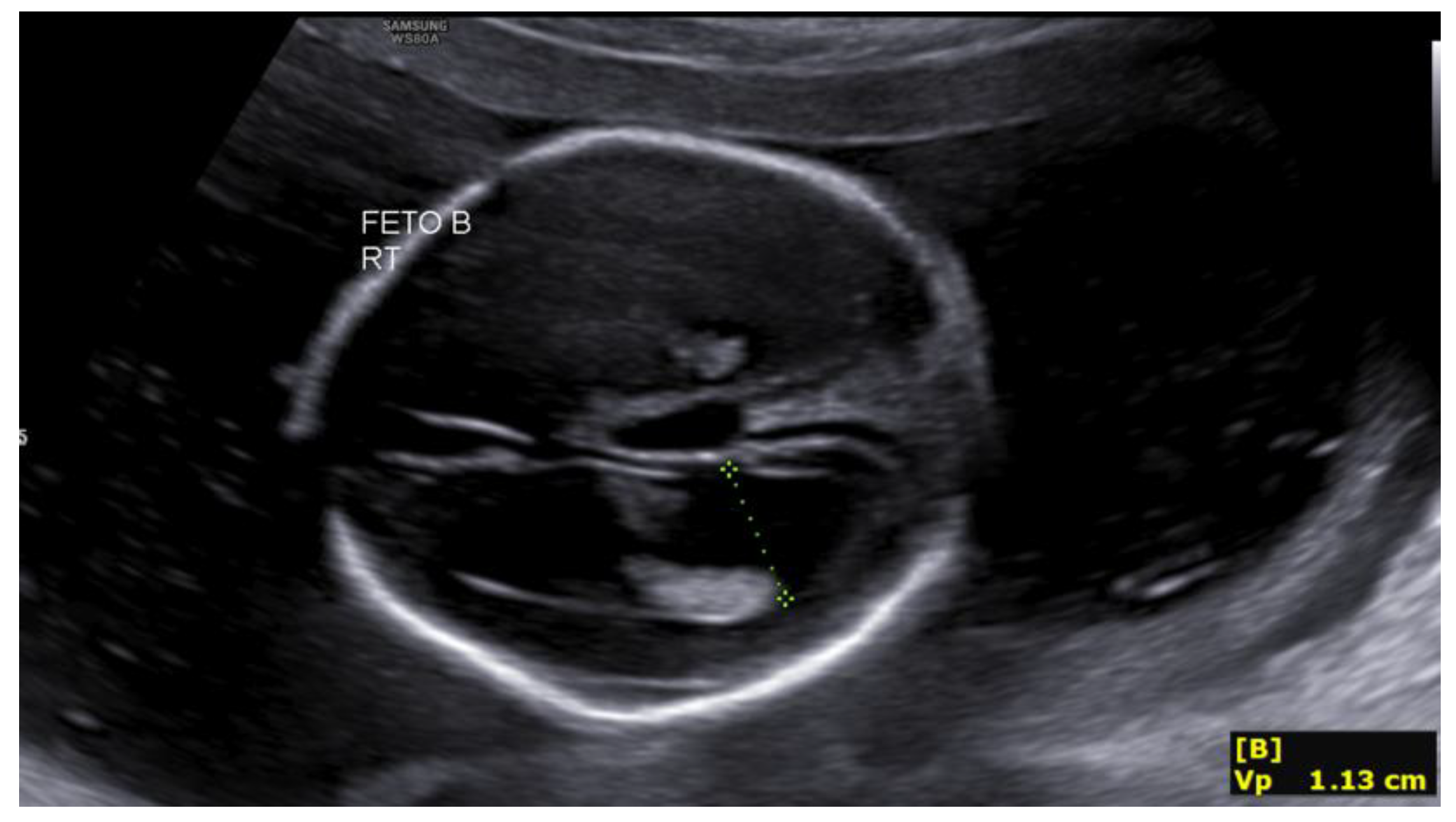 Preprints 188995 g001