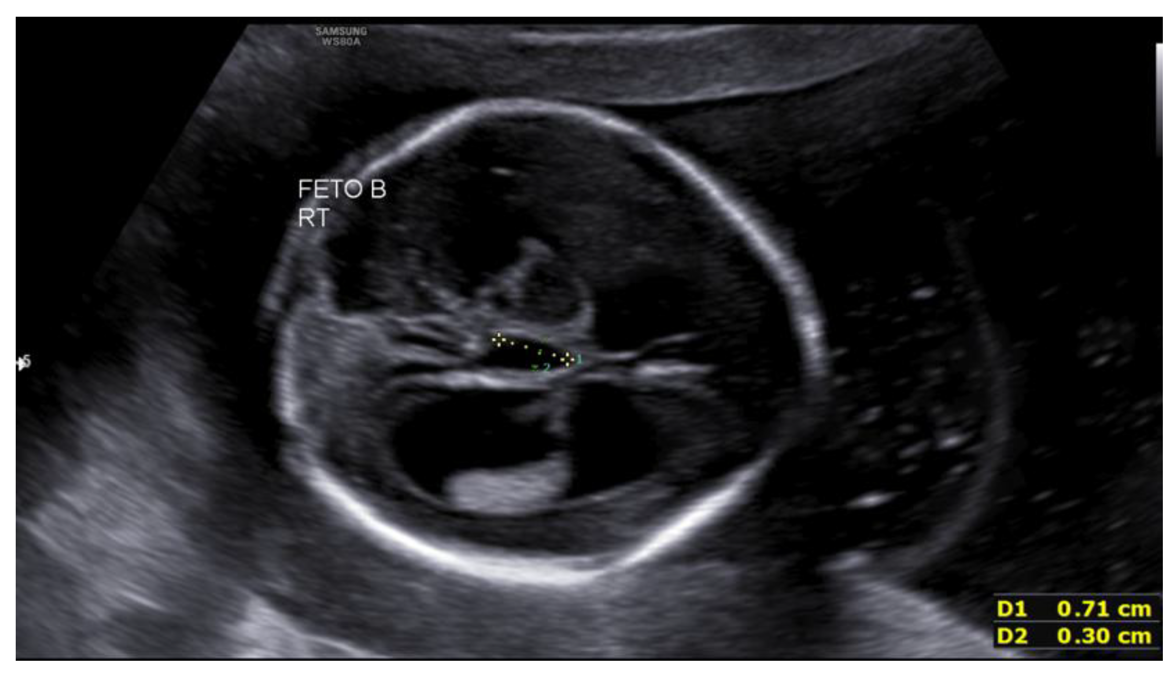 Preprints 188995 g002