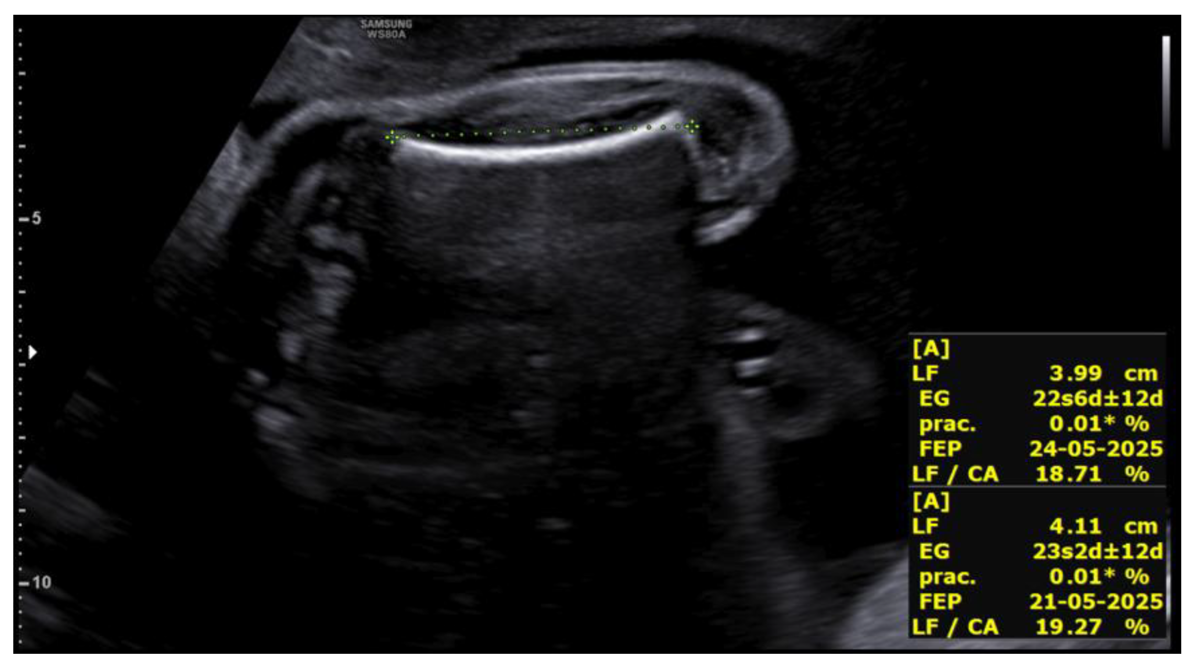 Preprints 188995 g004