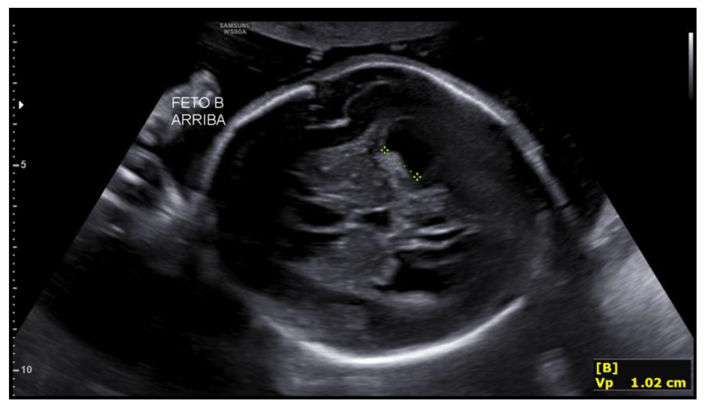 Preprints 188995 g006