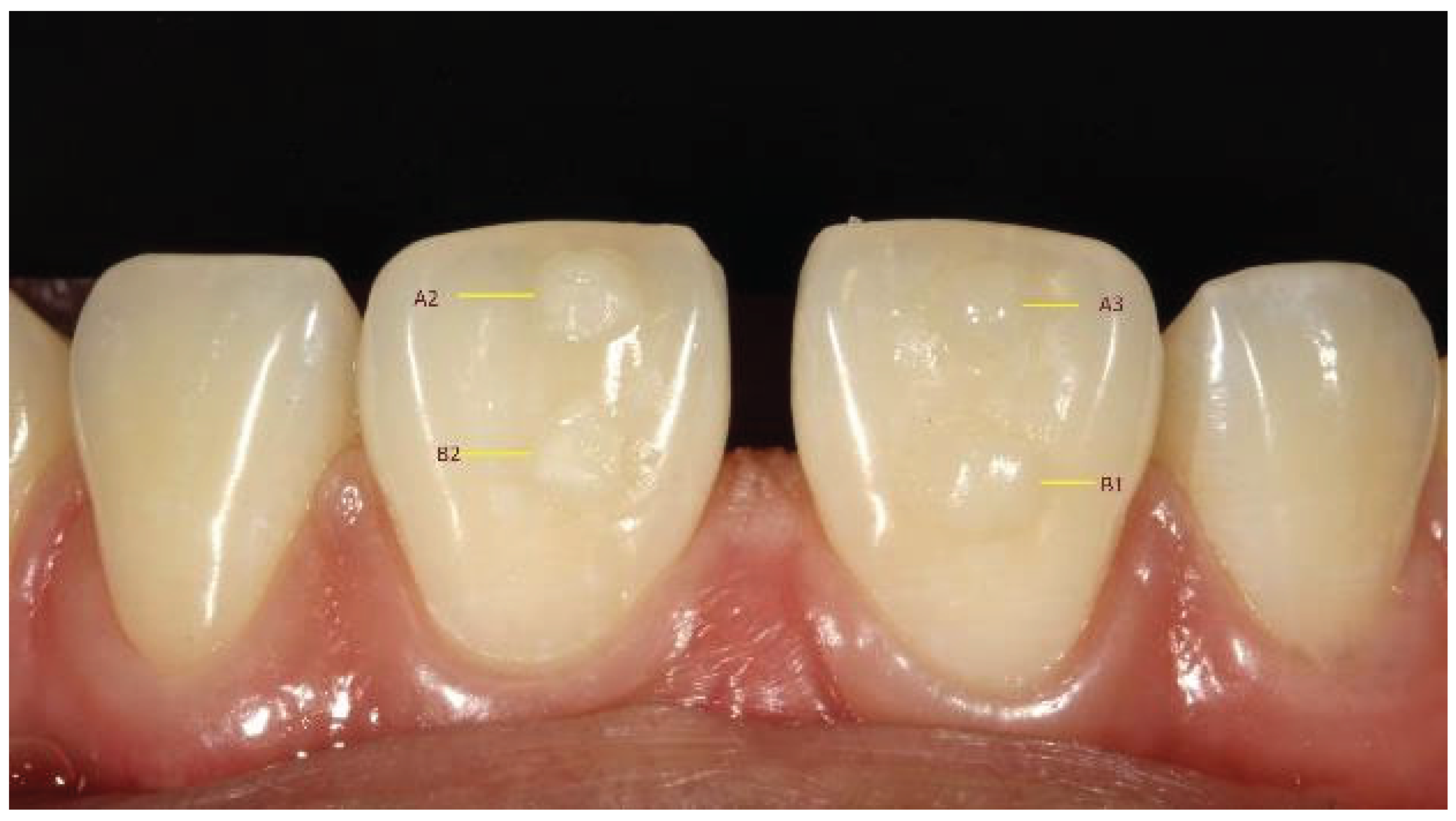 Preprints 167201 g003