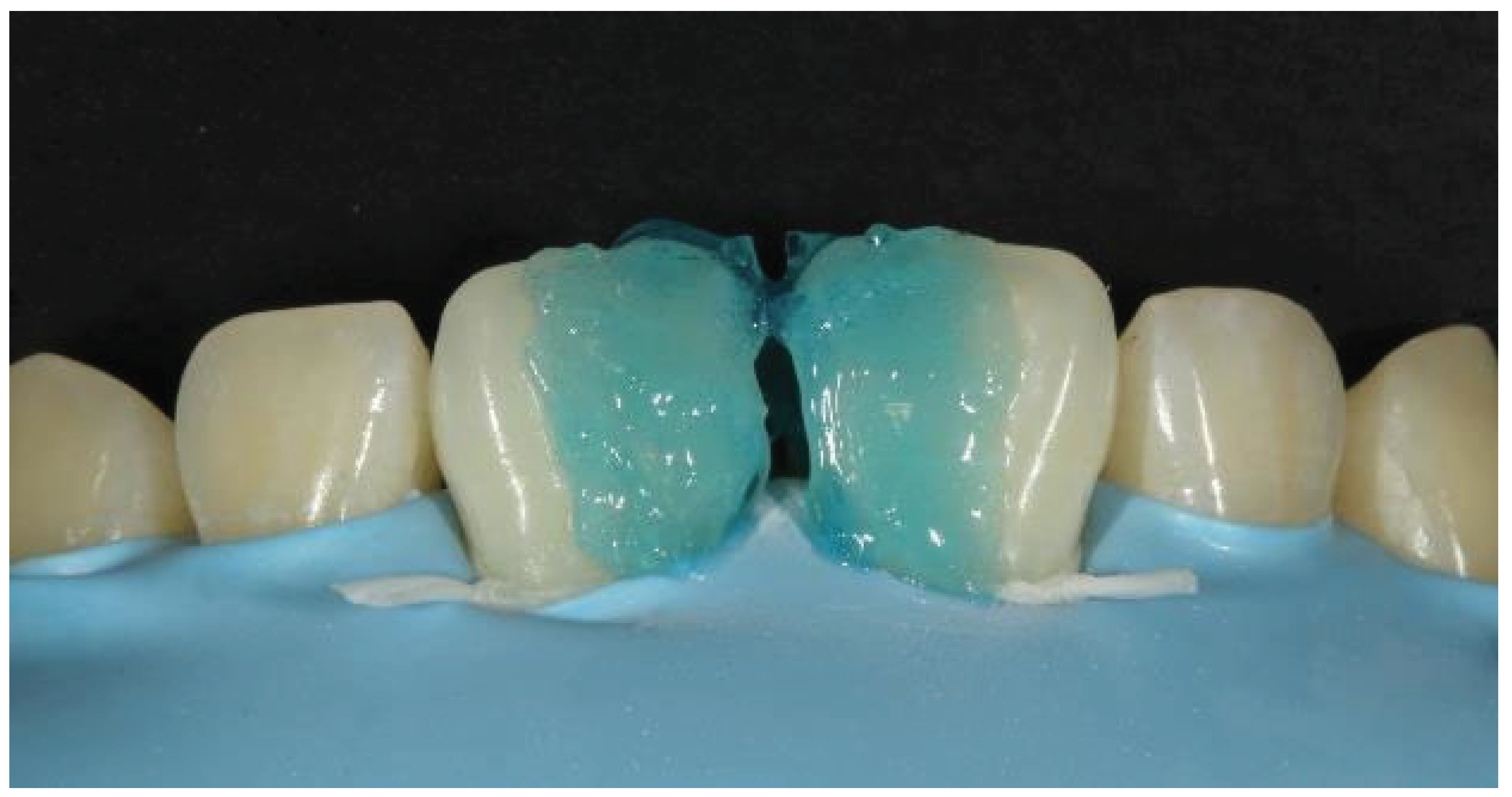 Preprints 167201 g004