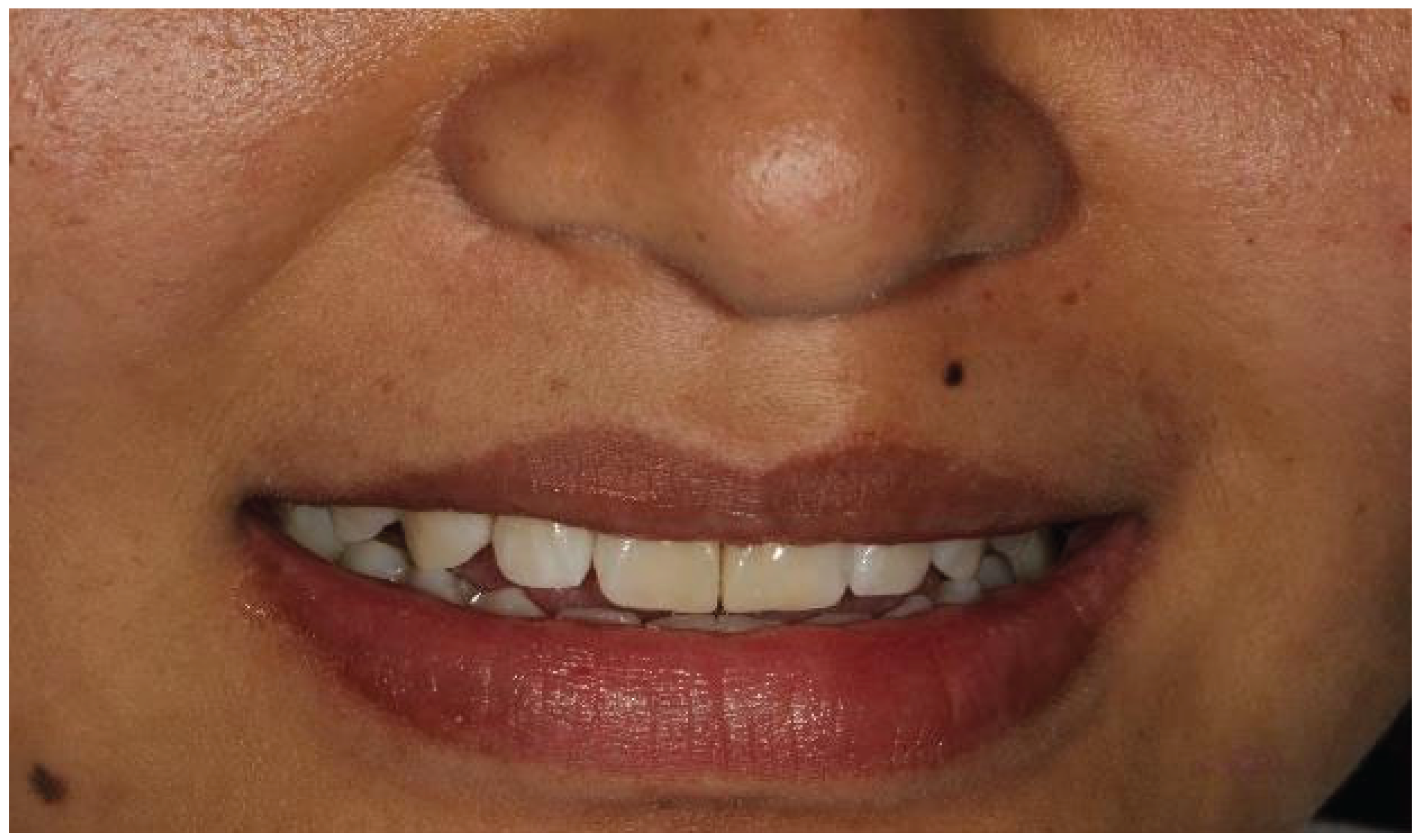 Preprints 167201 g007b