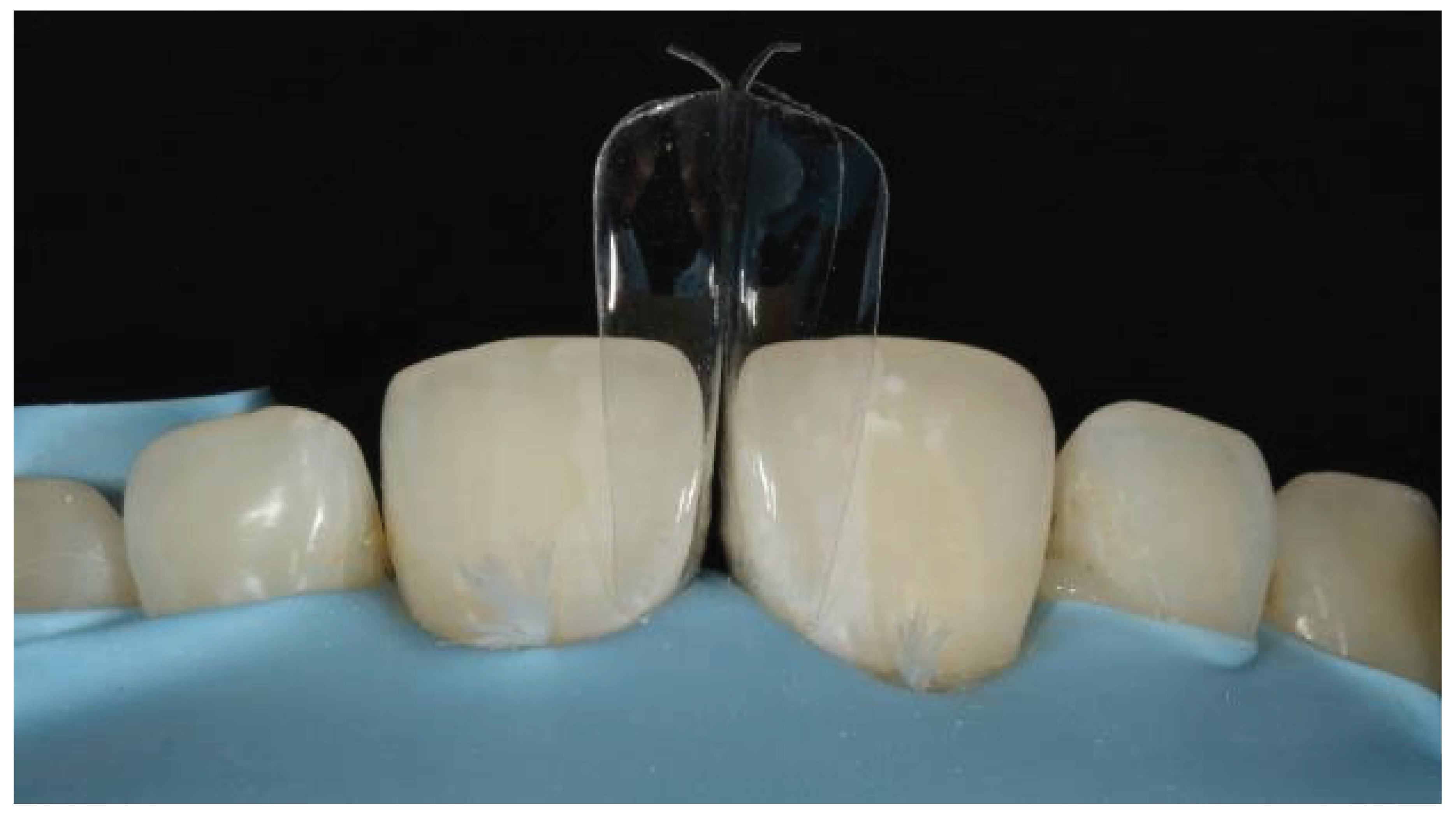 Preprints 167201 g011