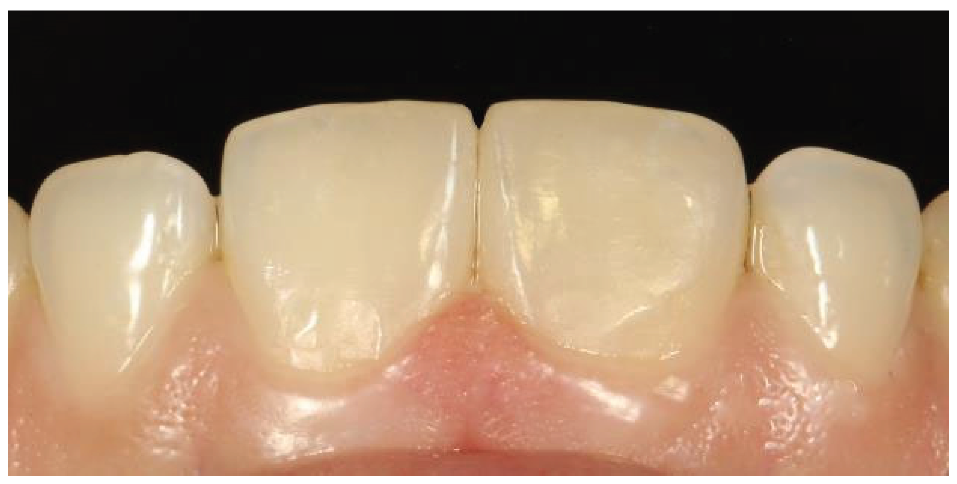 Preprints 167201 g016