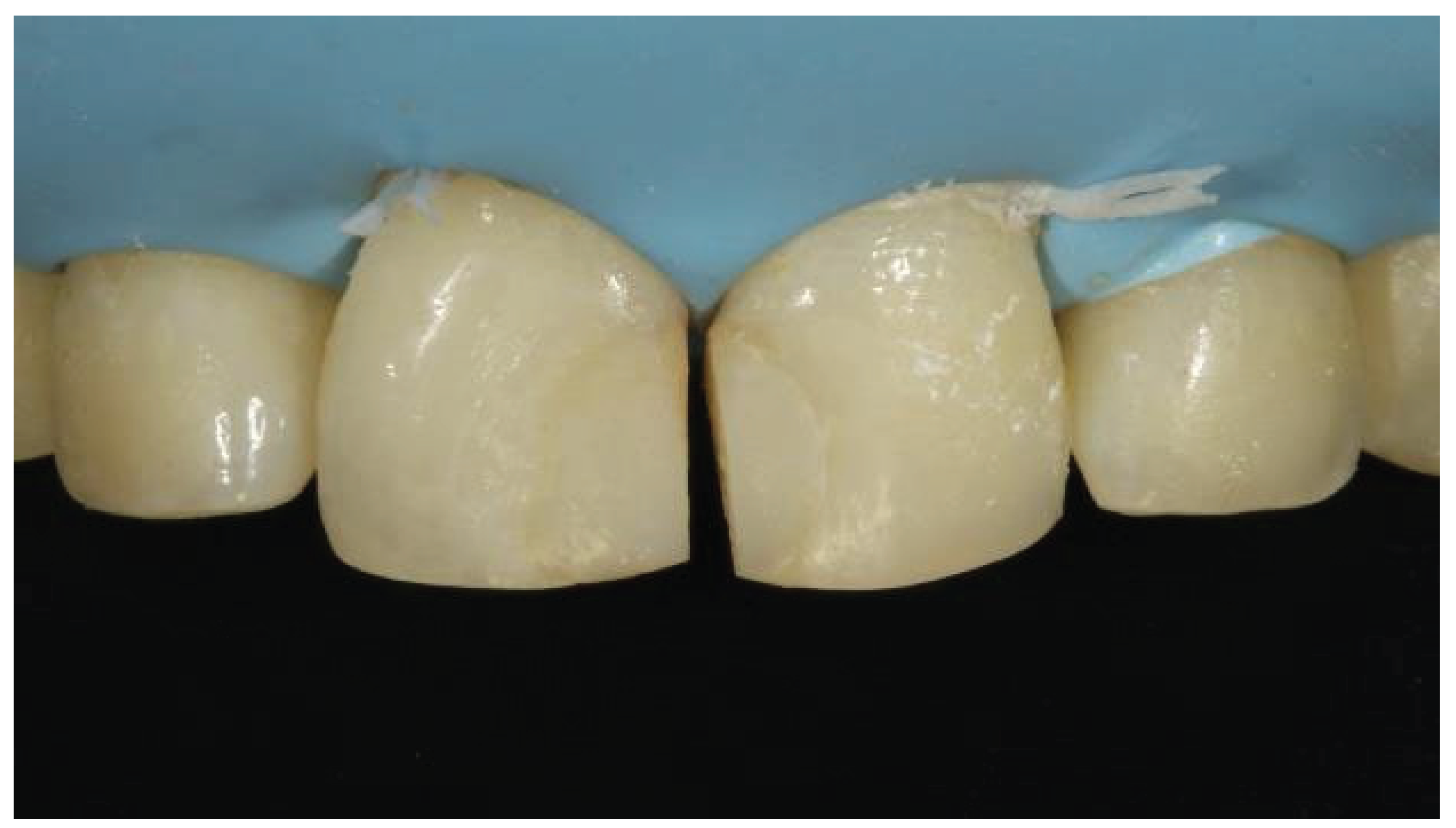 Preprints 167201 g018