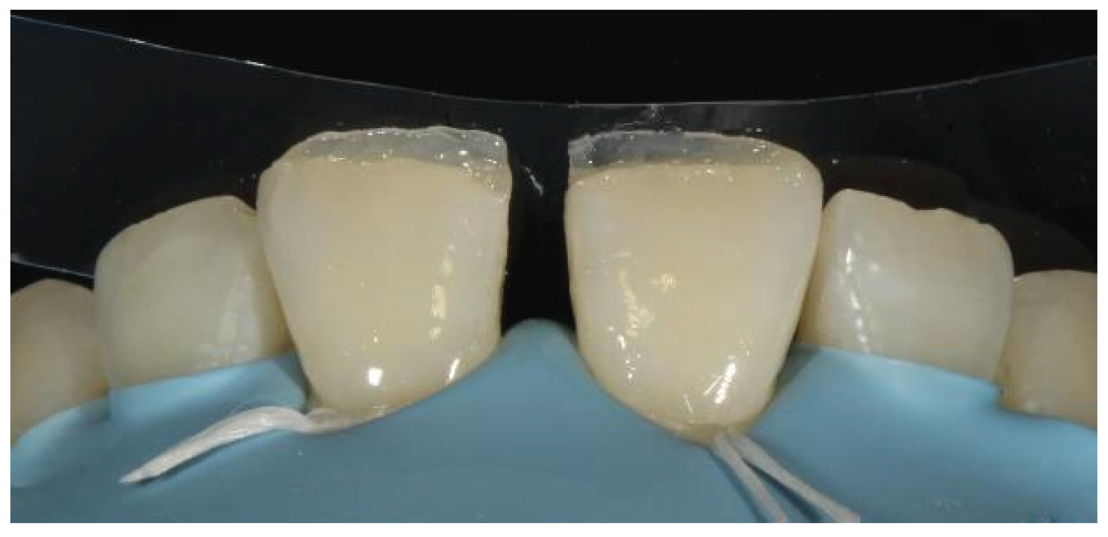 Preprints 167201 g032