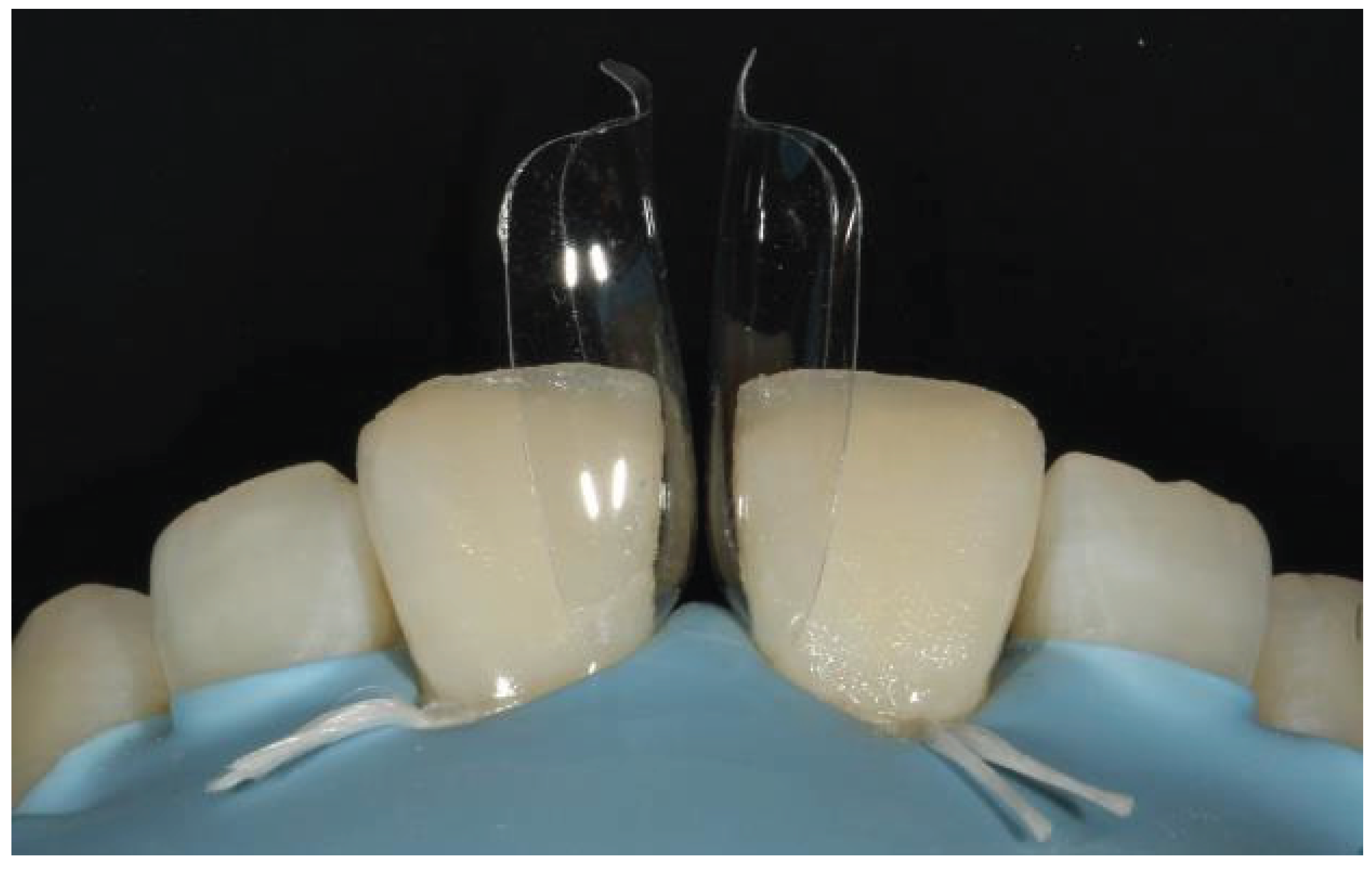 Preprints 167201 g033