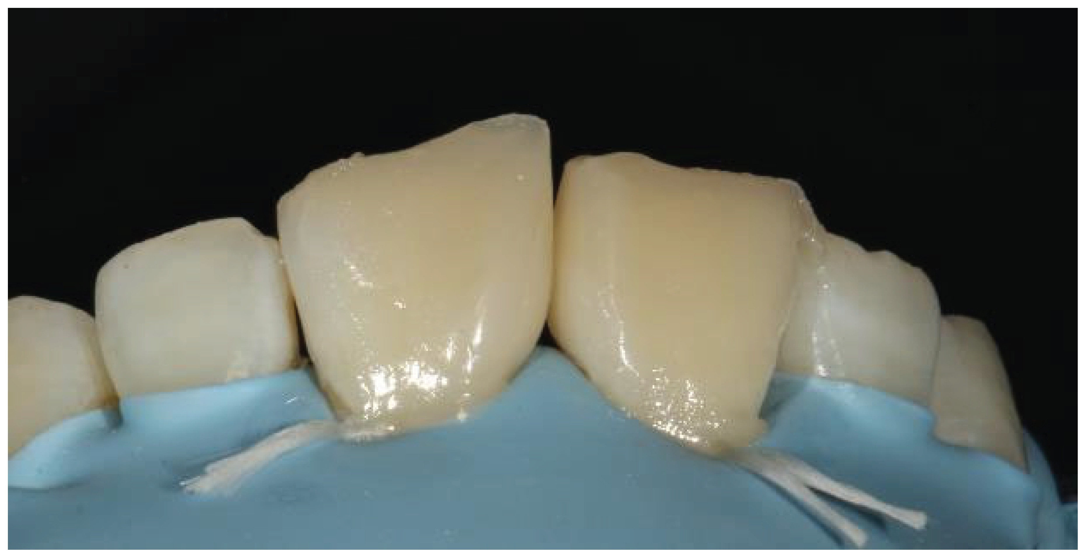 Preprints 167201 g035