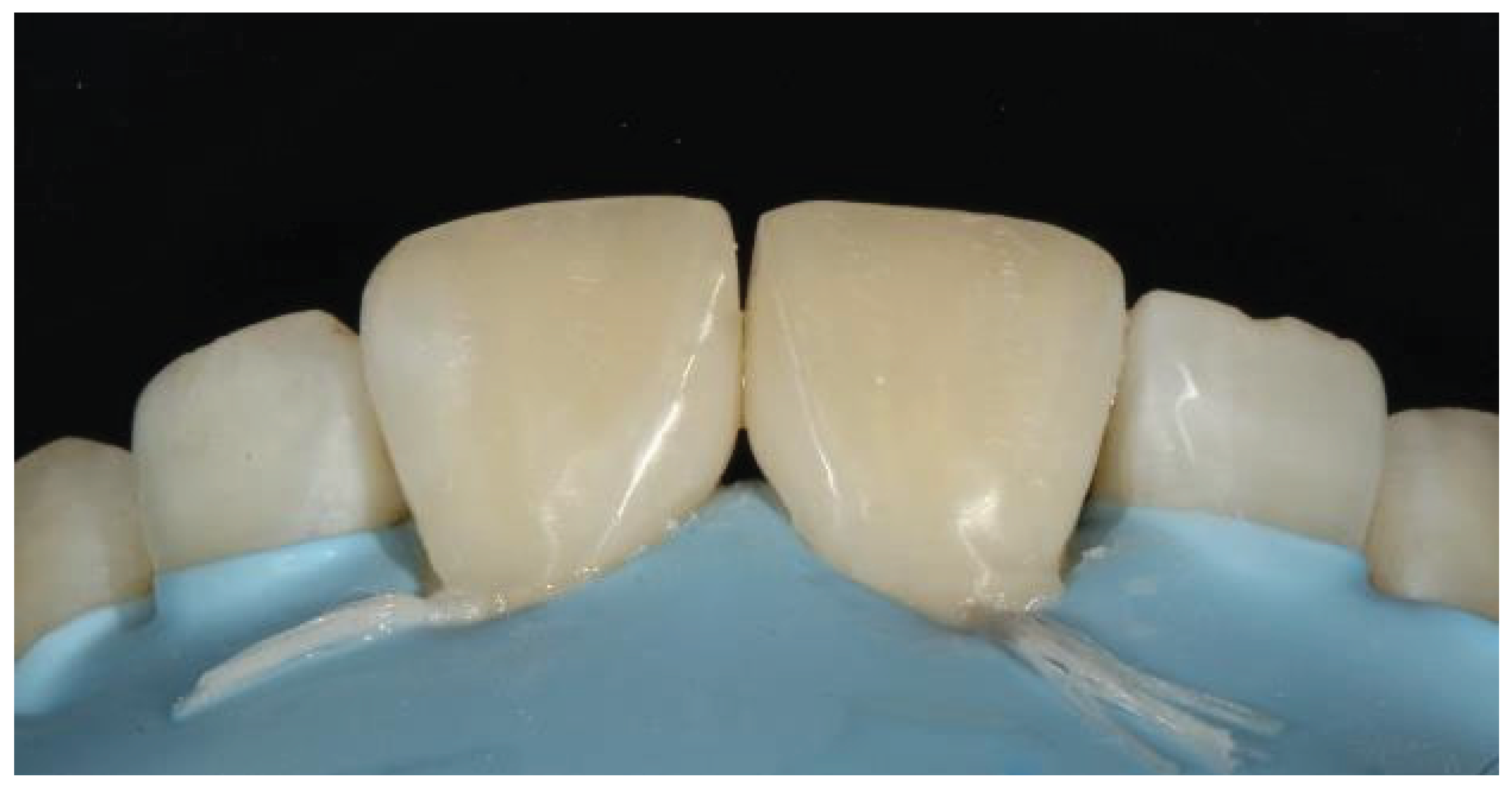 Preprints 167201 g037