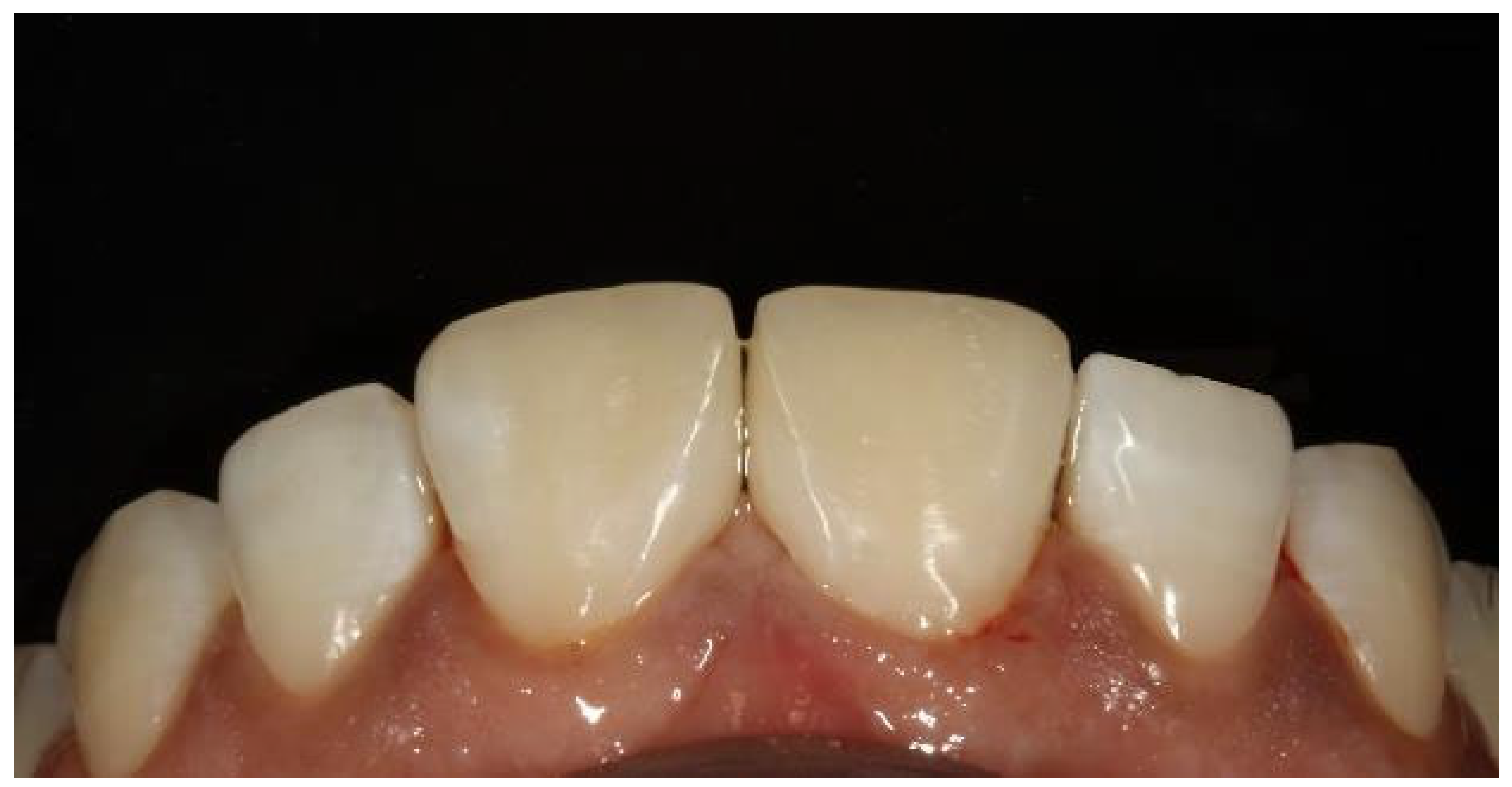 Preprints 167201 g038