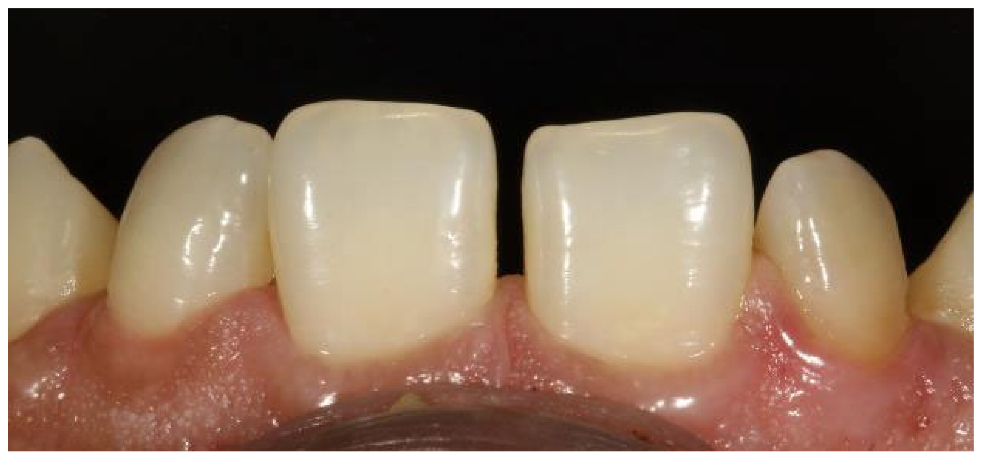 Preprints 167201 g039