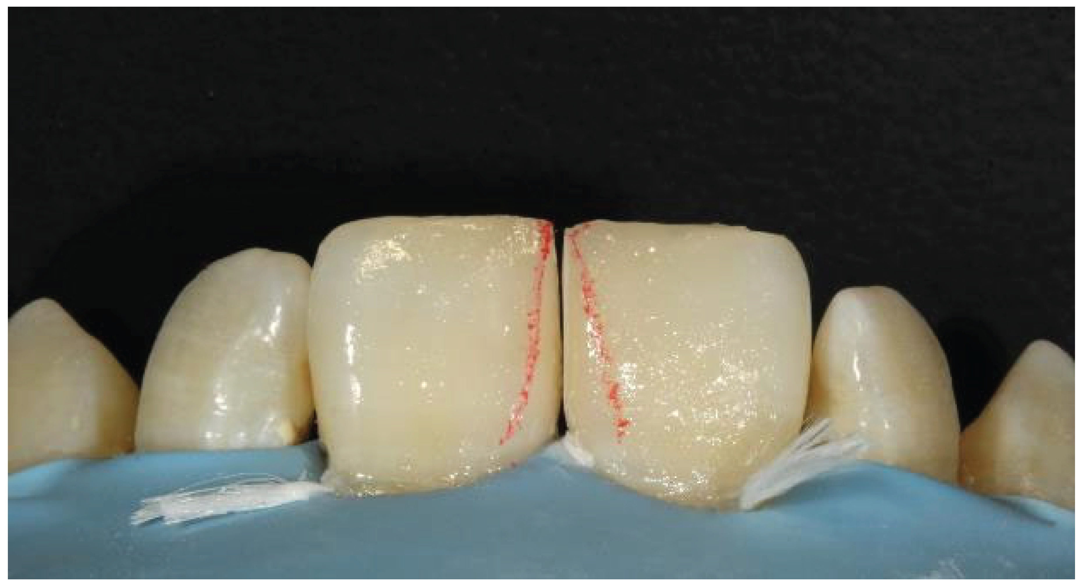 Preprints 167201 g046