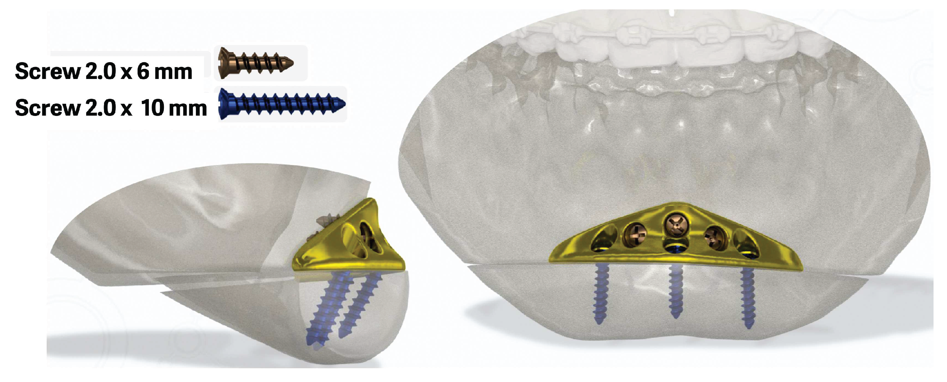 Preprints 169450 g003