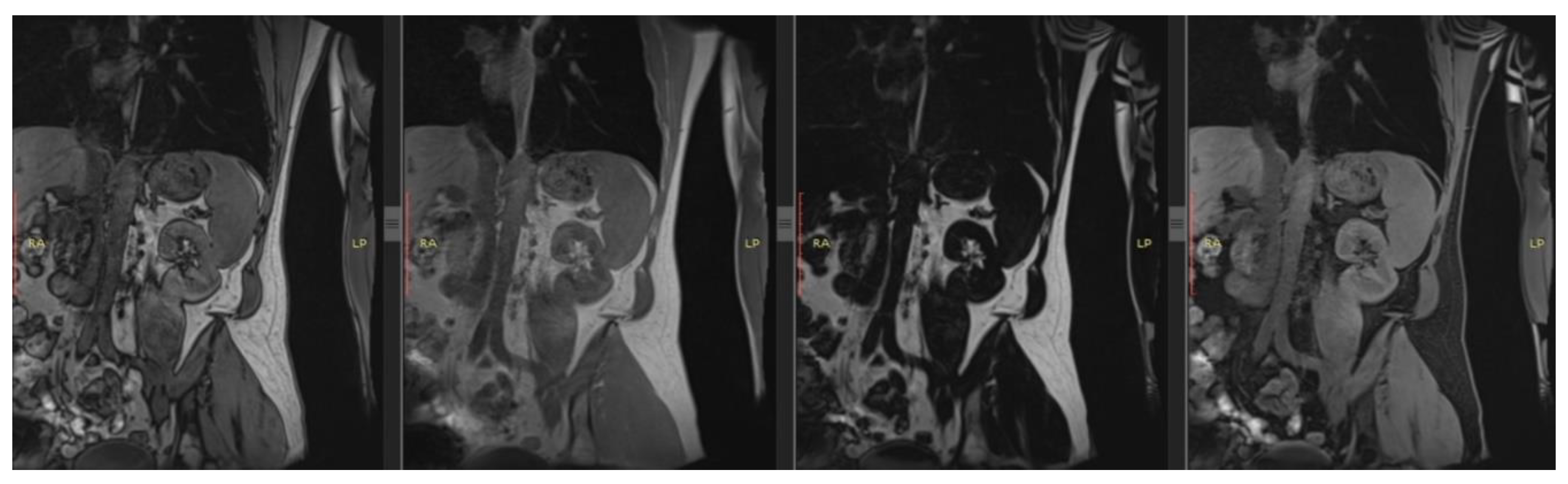 Preprints 165706 g001