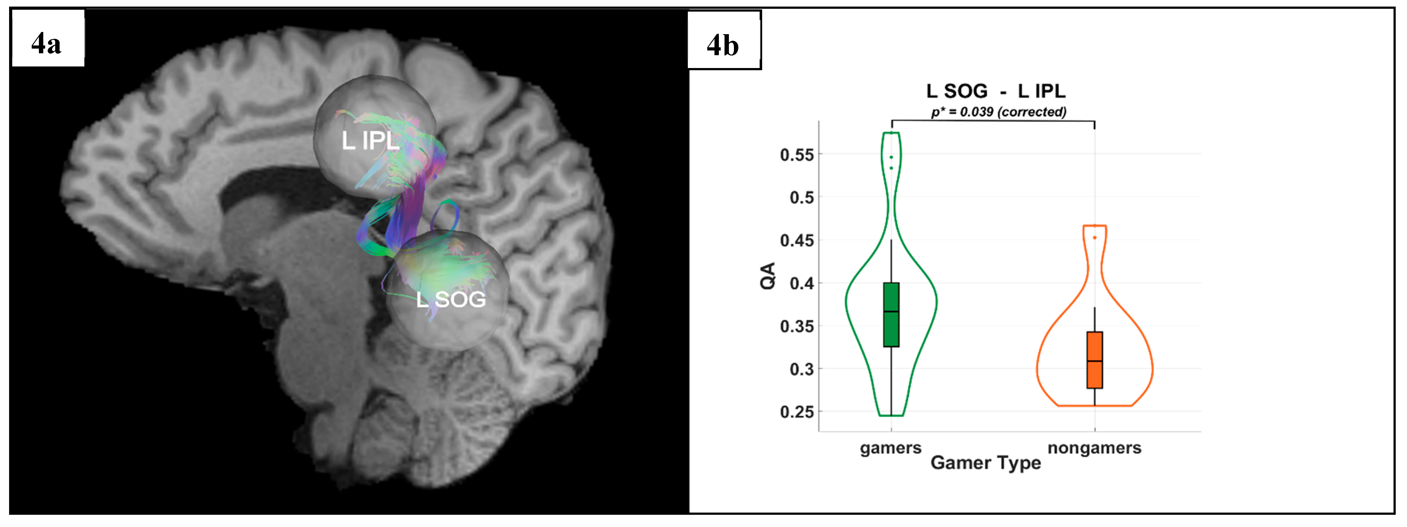 Preprints 169862 g004