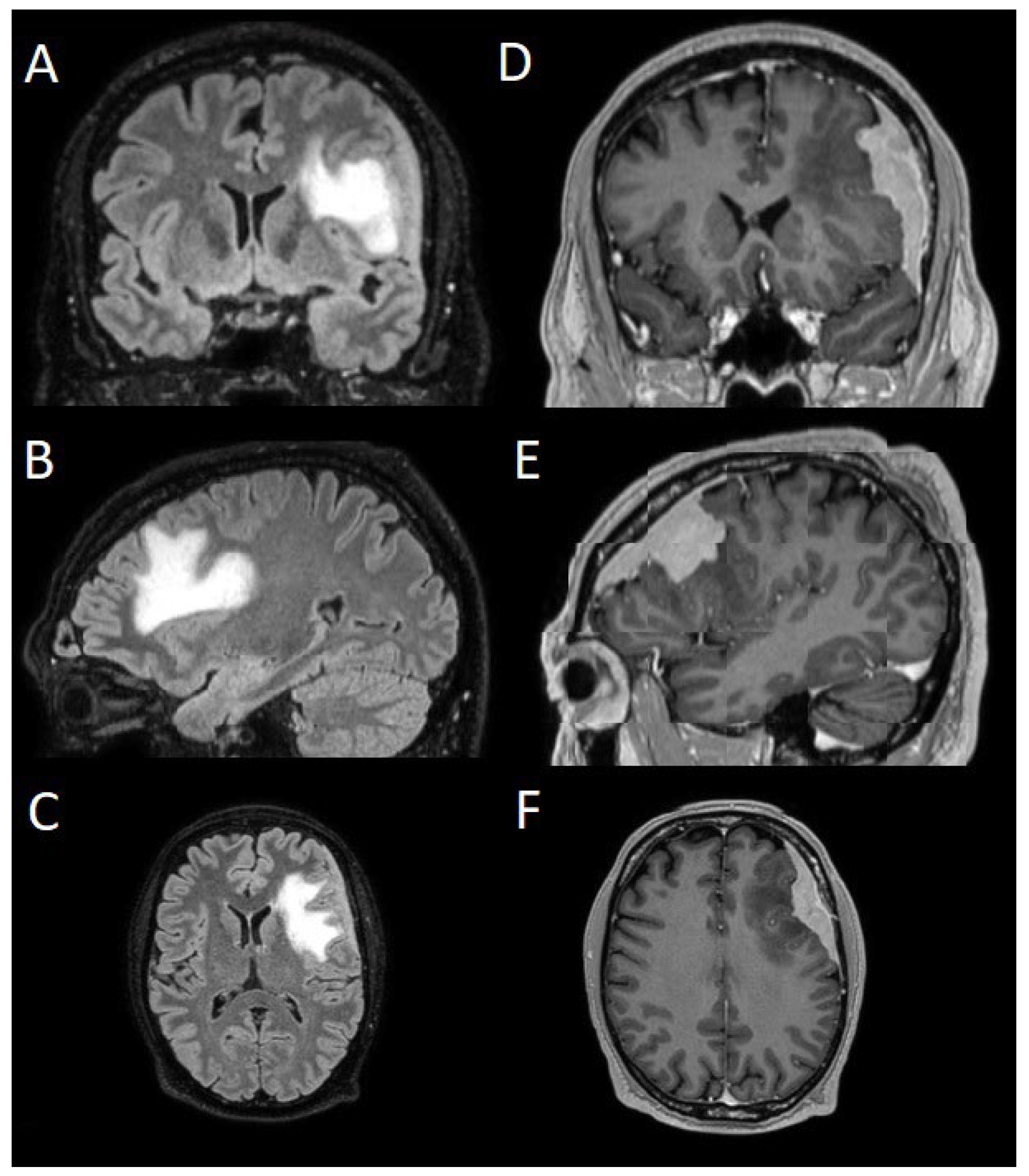 Preprints 152917 g001