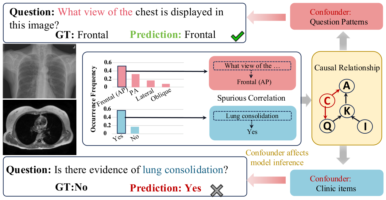 Causal Dual-Interventional MedVQA via Textual Perturbation and ...