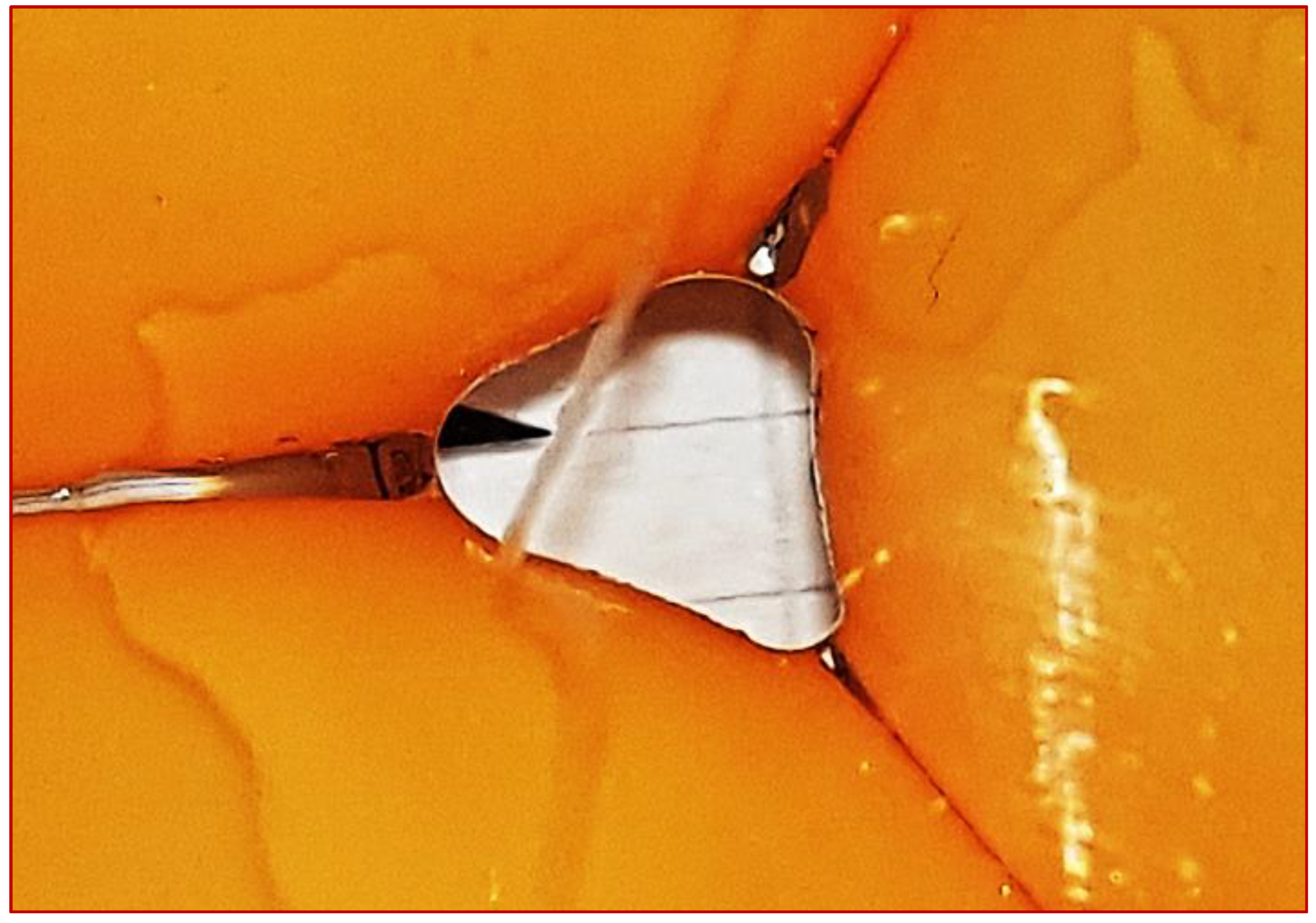 Preprints 160308 g002