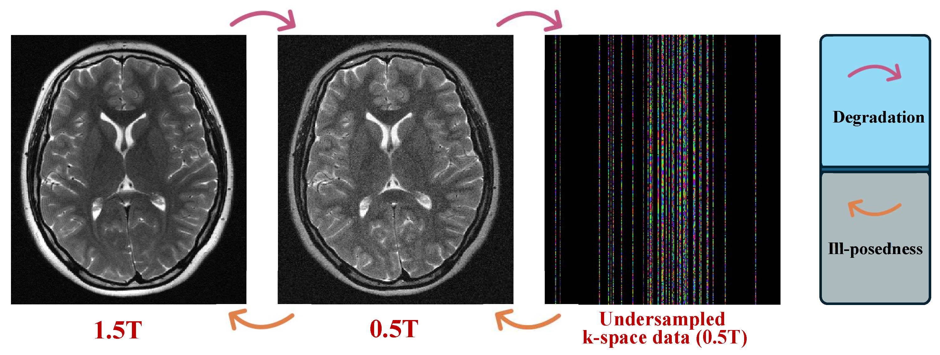 Meta-Learning–Driven Score-Based Generative Model for 0.5T-to-1.5T