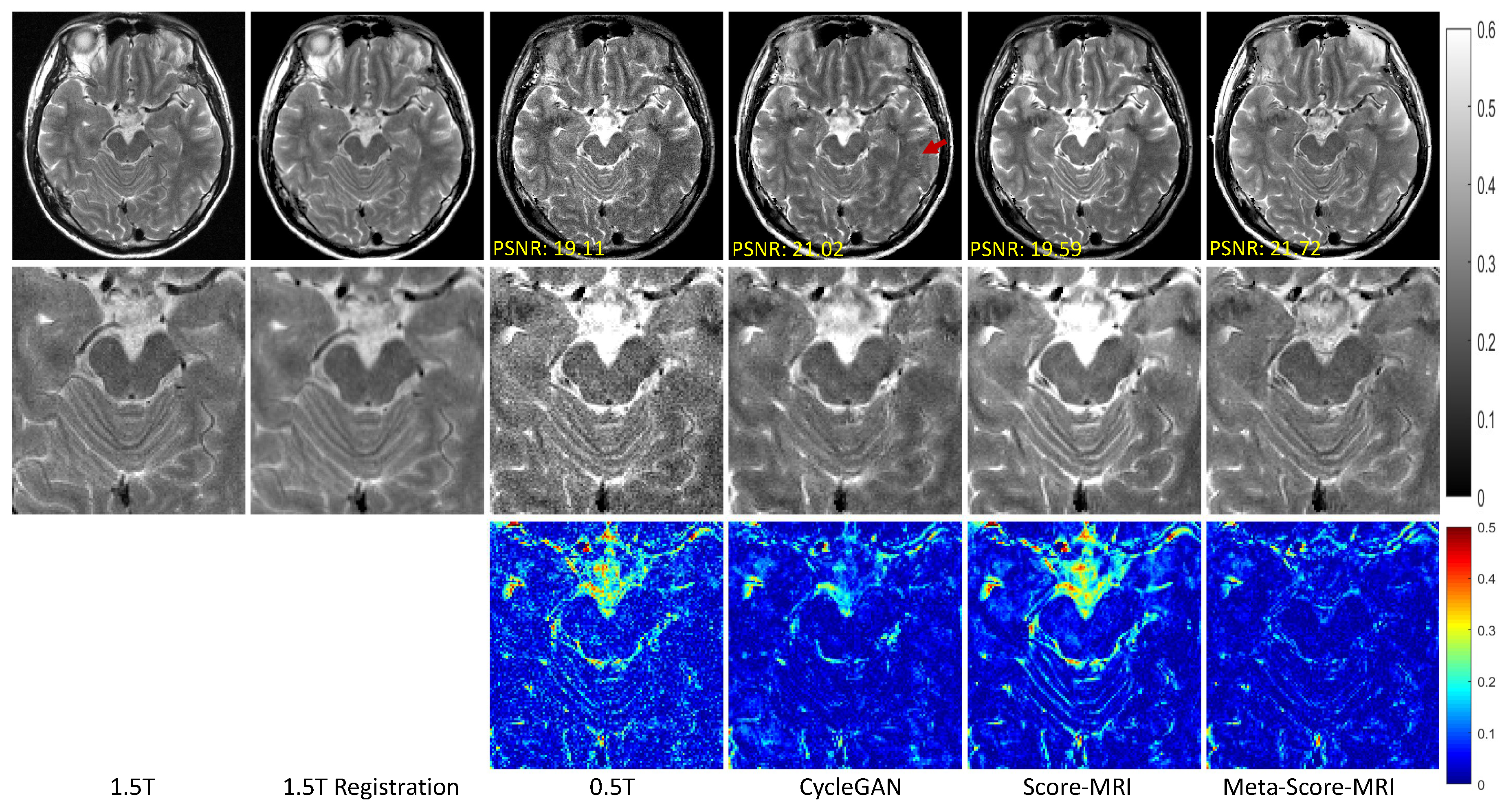 Meta-Learning–Driven Score-Based Generative Model for 0.5T-to-1.5T