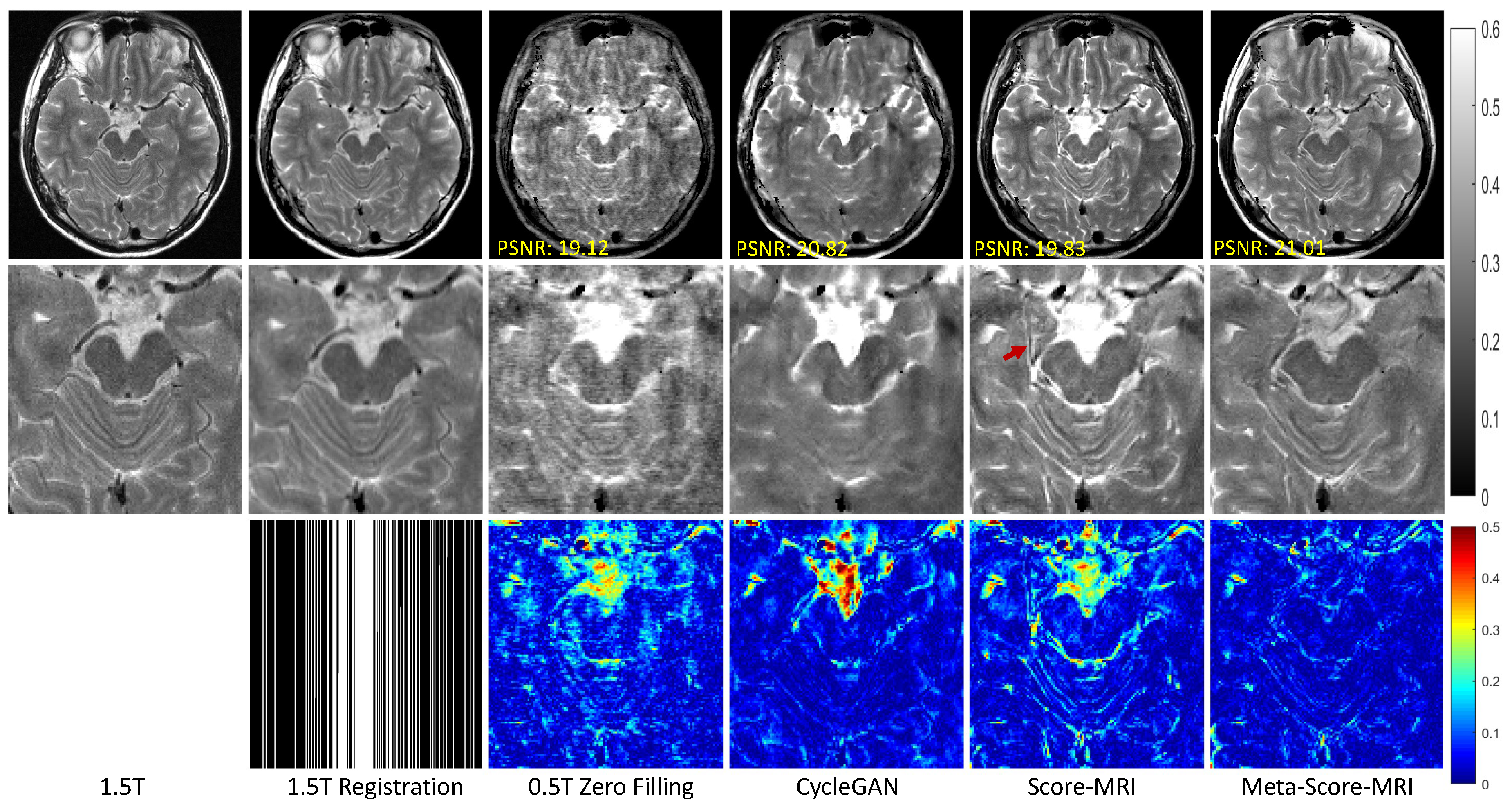 Meta-Learning–Driven Score-Based Generative Model for 0.5T-to-1.5T