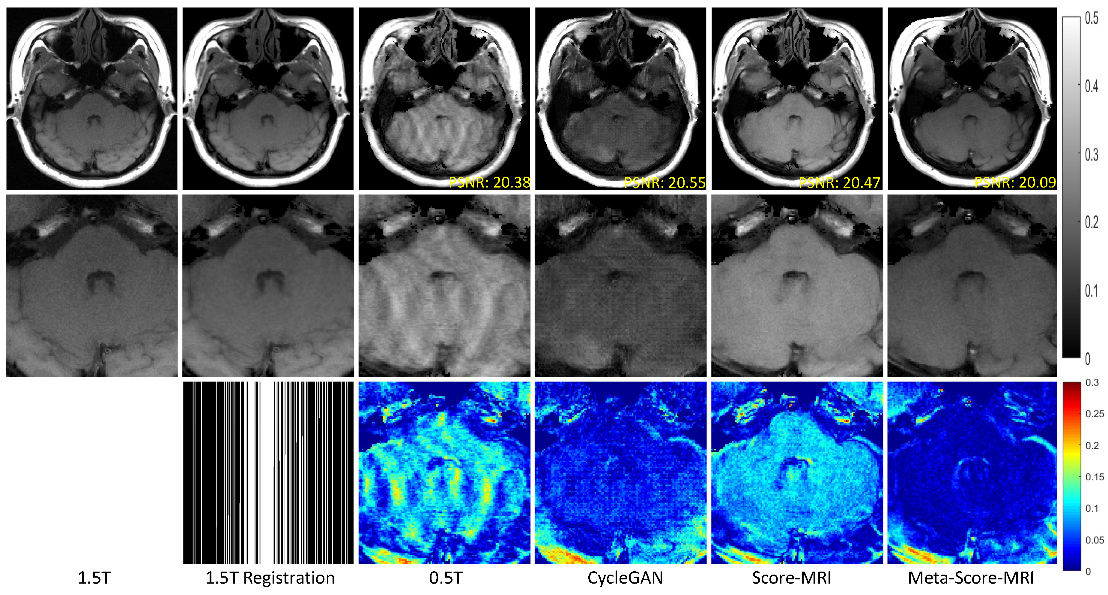 Meta-Learning–Driven Score-Based Generative Model for 0.5T-to-1.5T