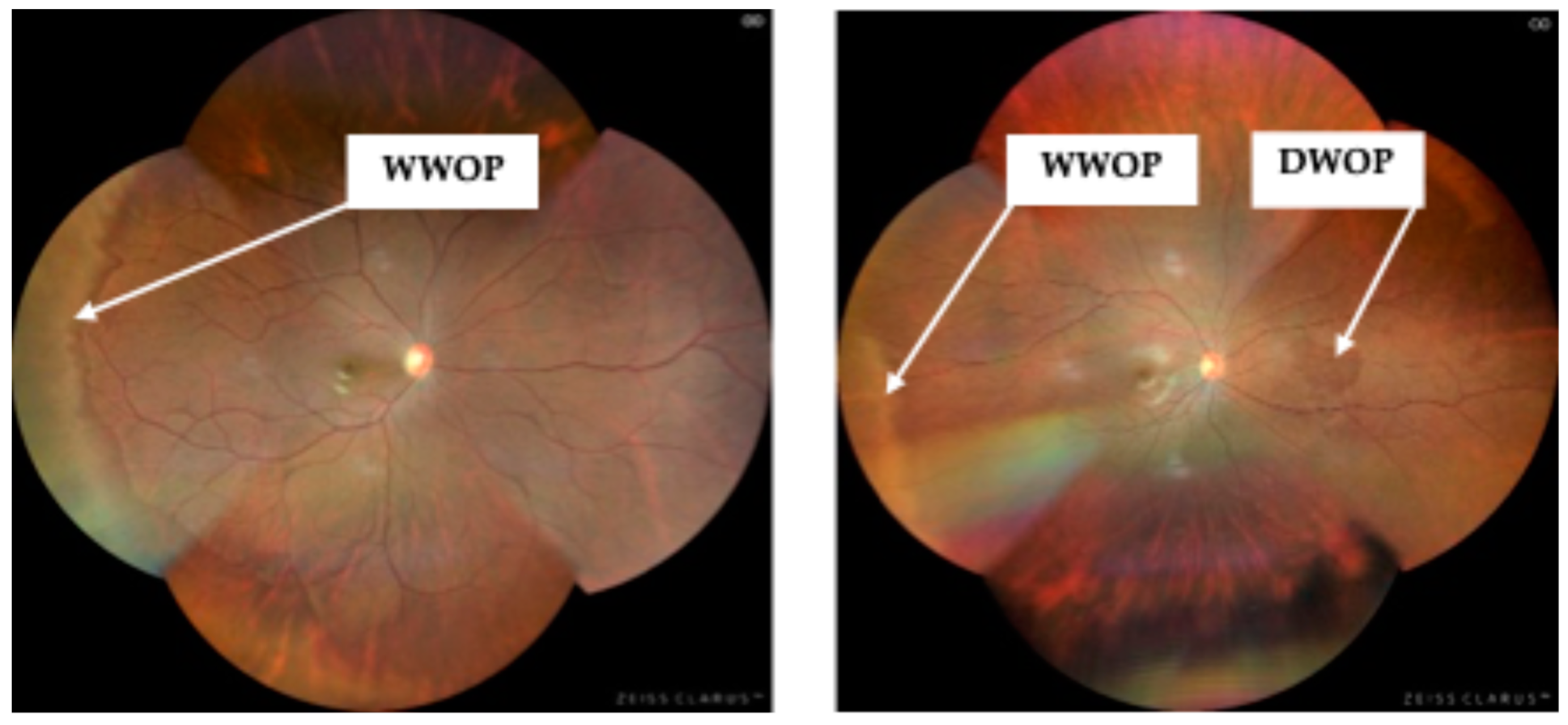 Preprints 155750 g001