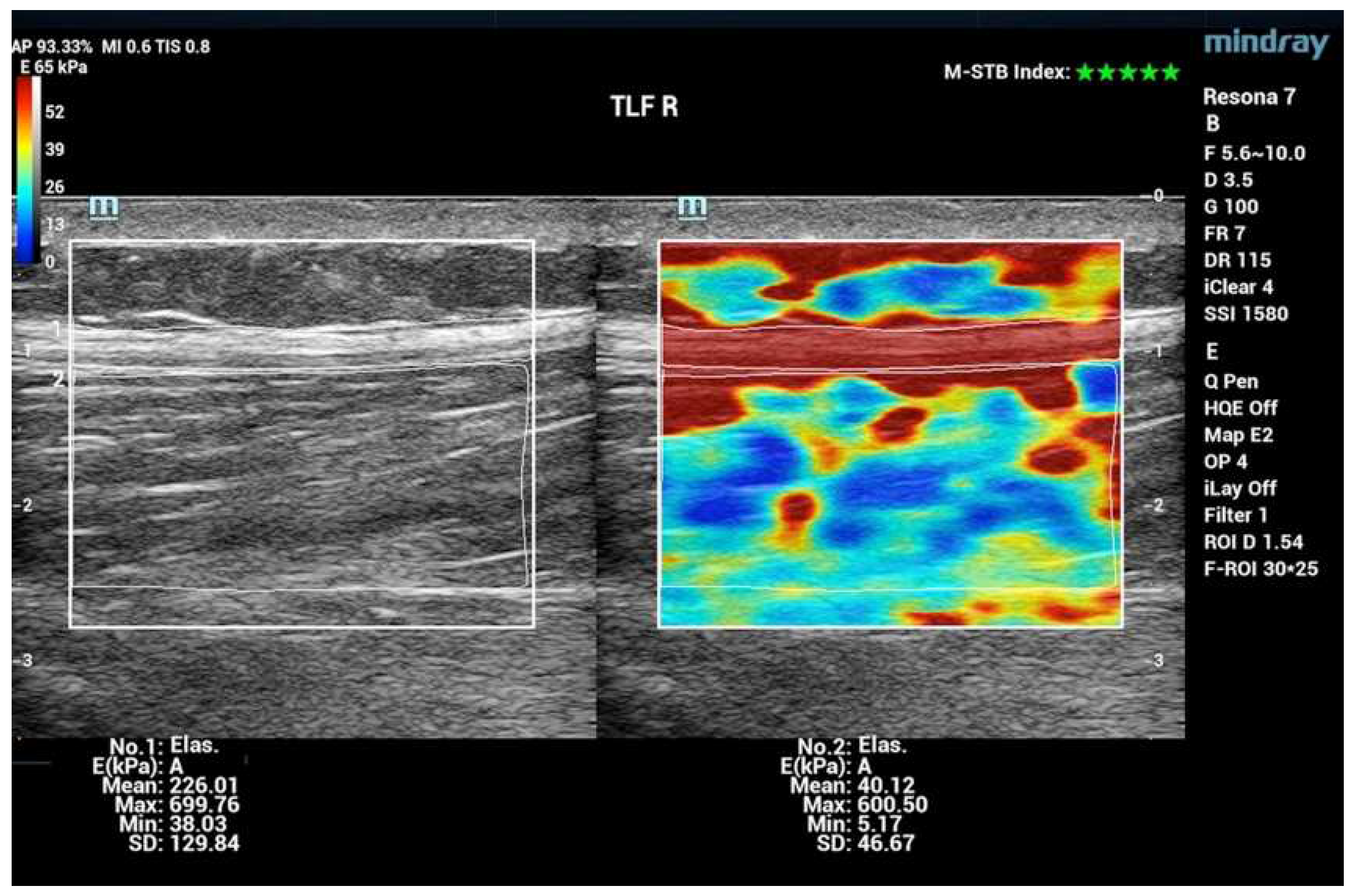 Preprints 89544 g005
