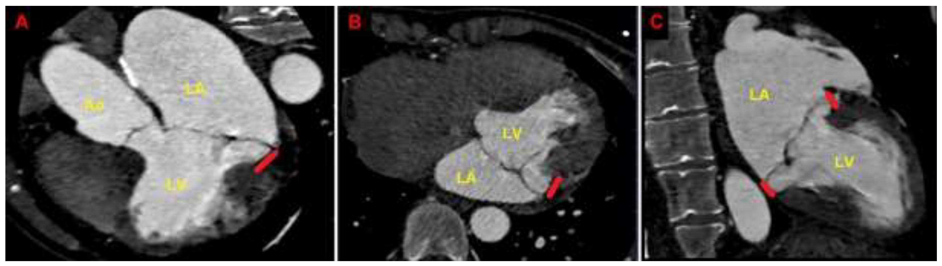 Preprints 150374 g006