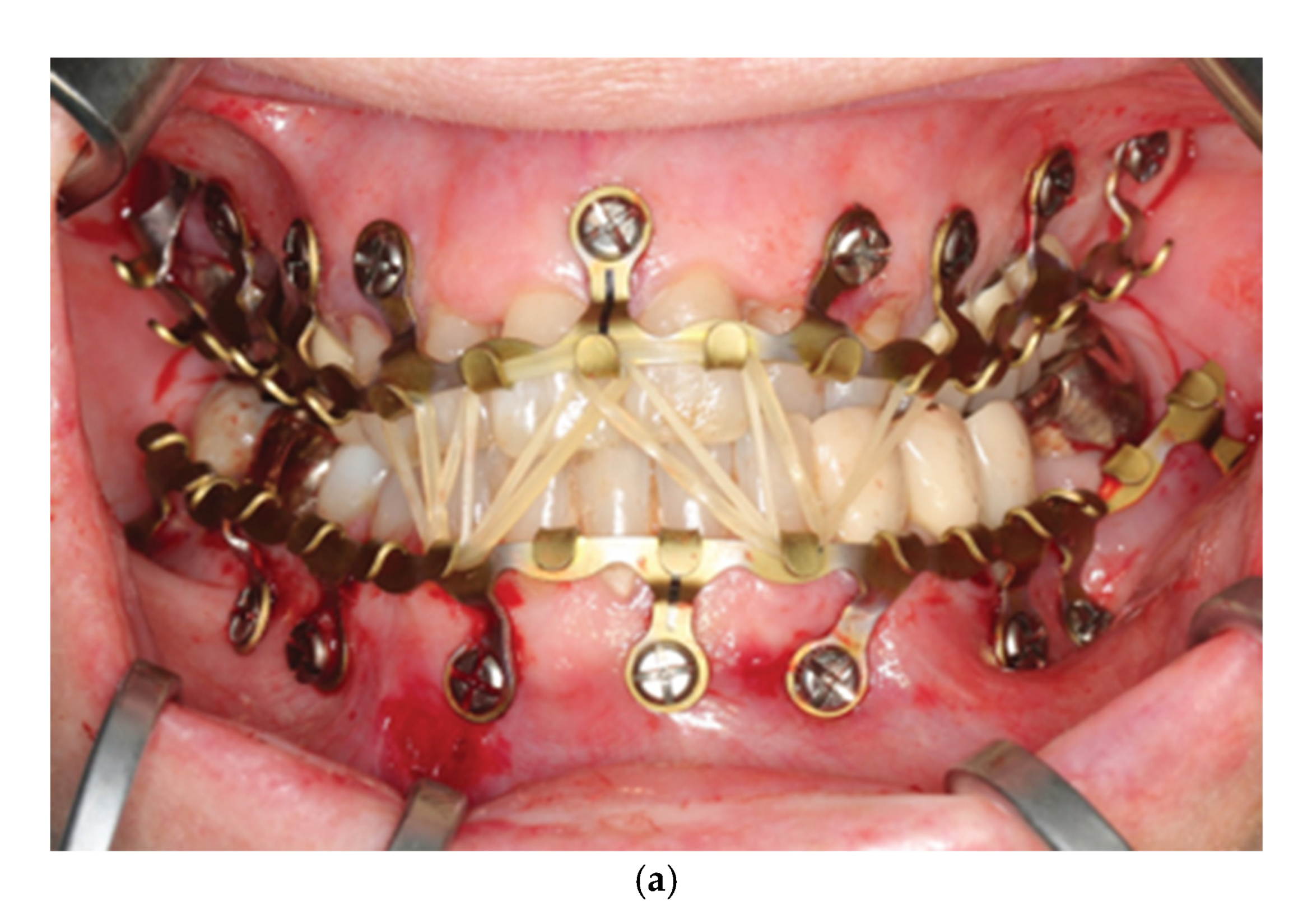 Preprints 150640 g002a