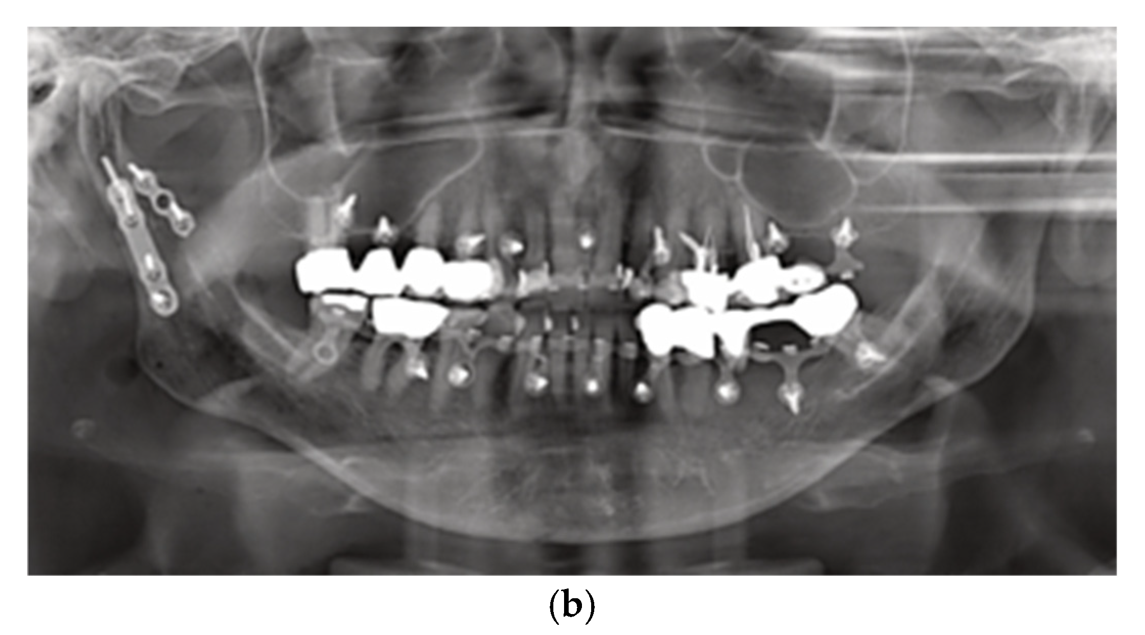 Preprints 150640 g002b
