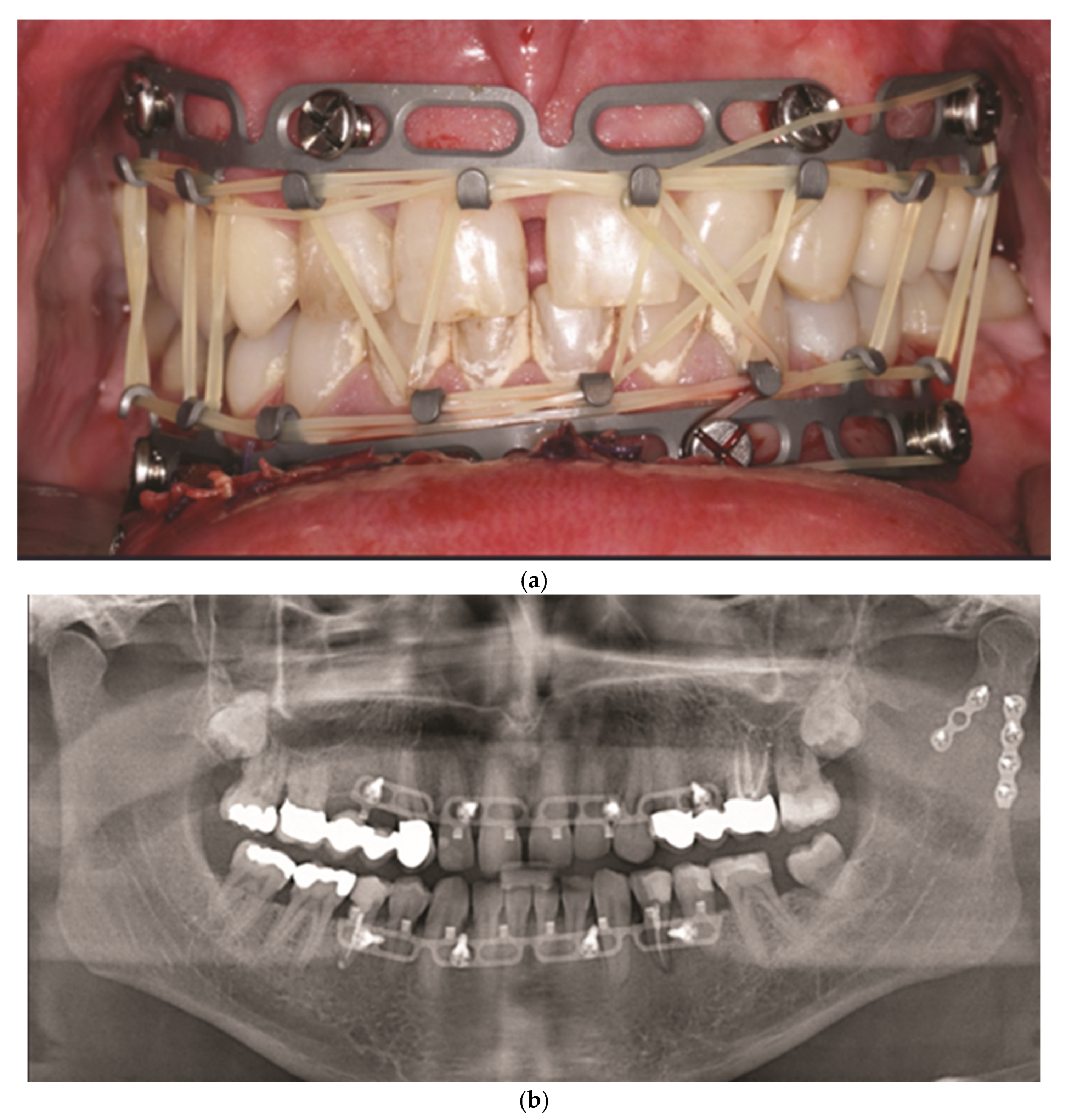 Preprints 150640 g004