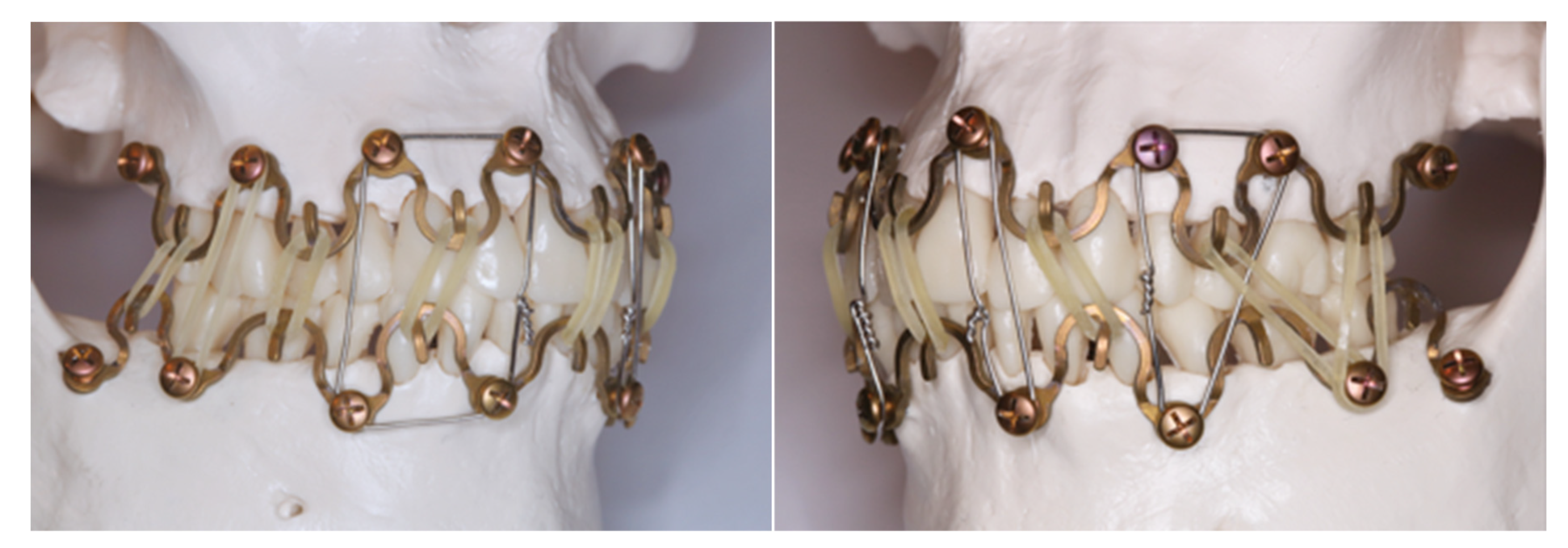 Preprints 150640 g017