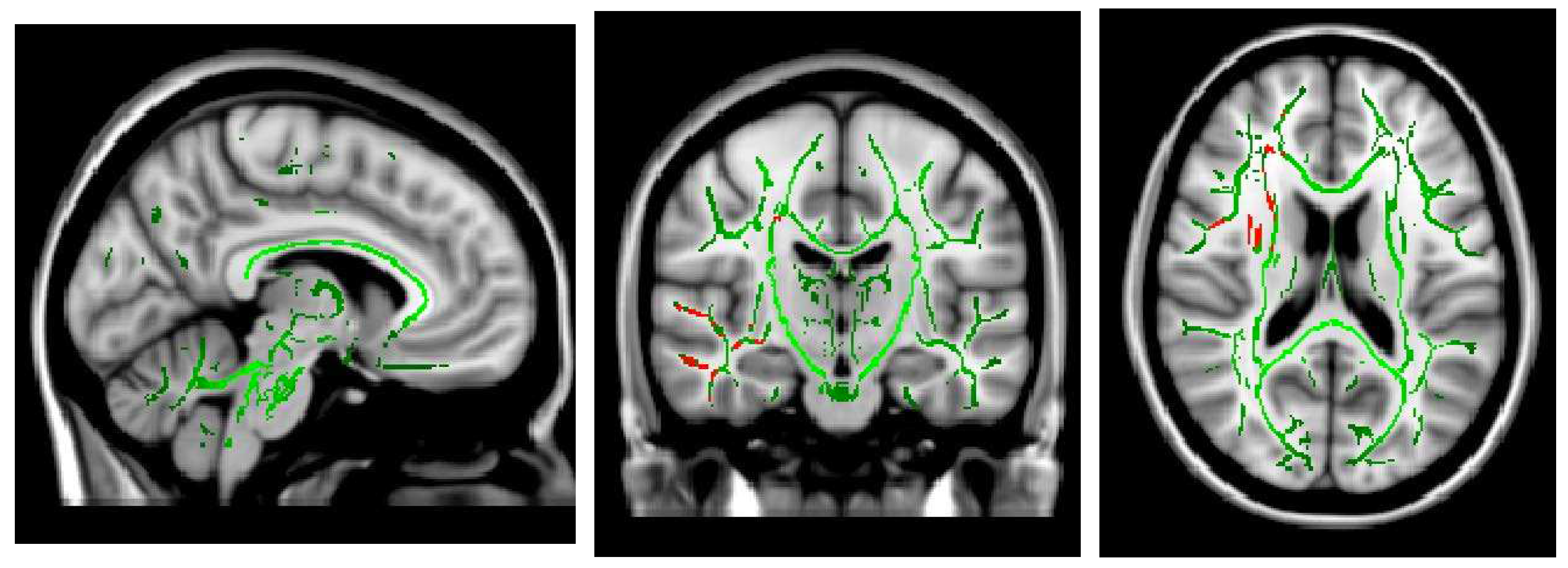Preprints 94535 g001