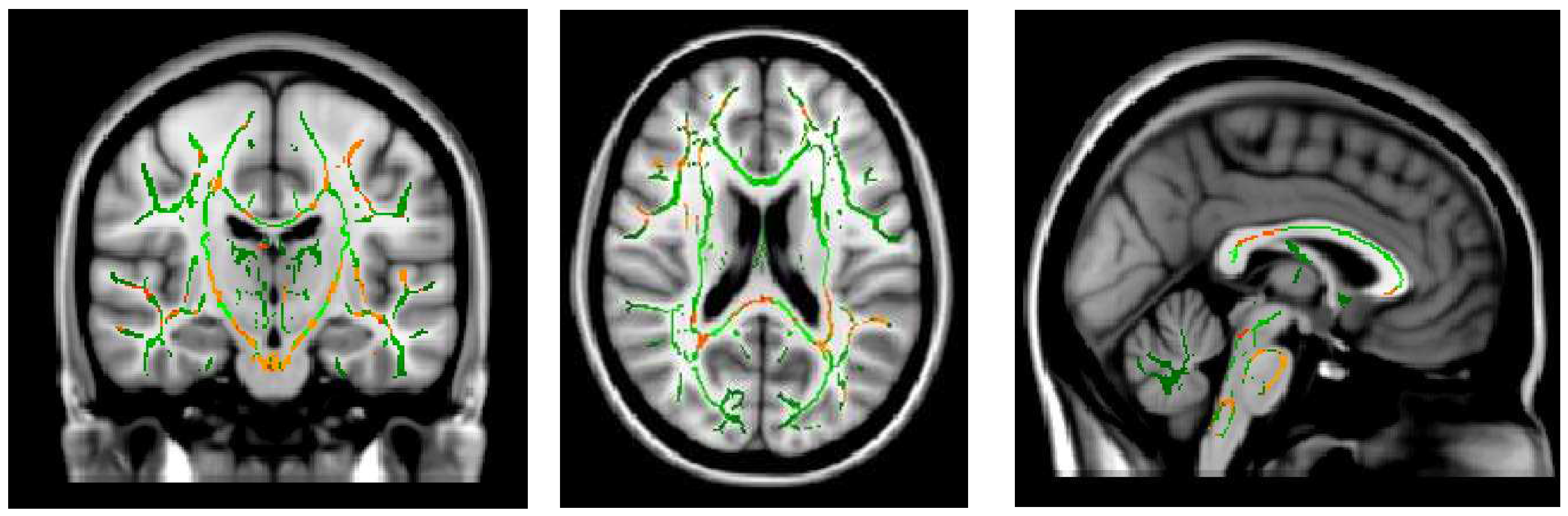Preprints 94535 g004