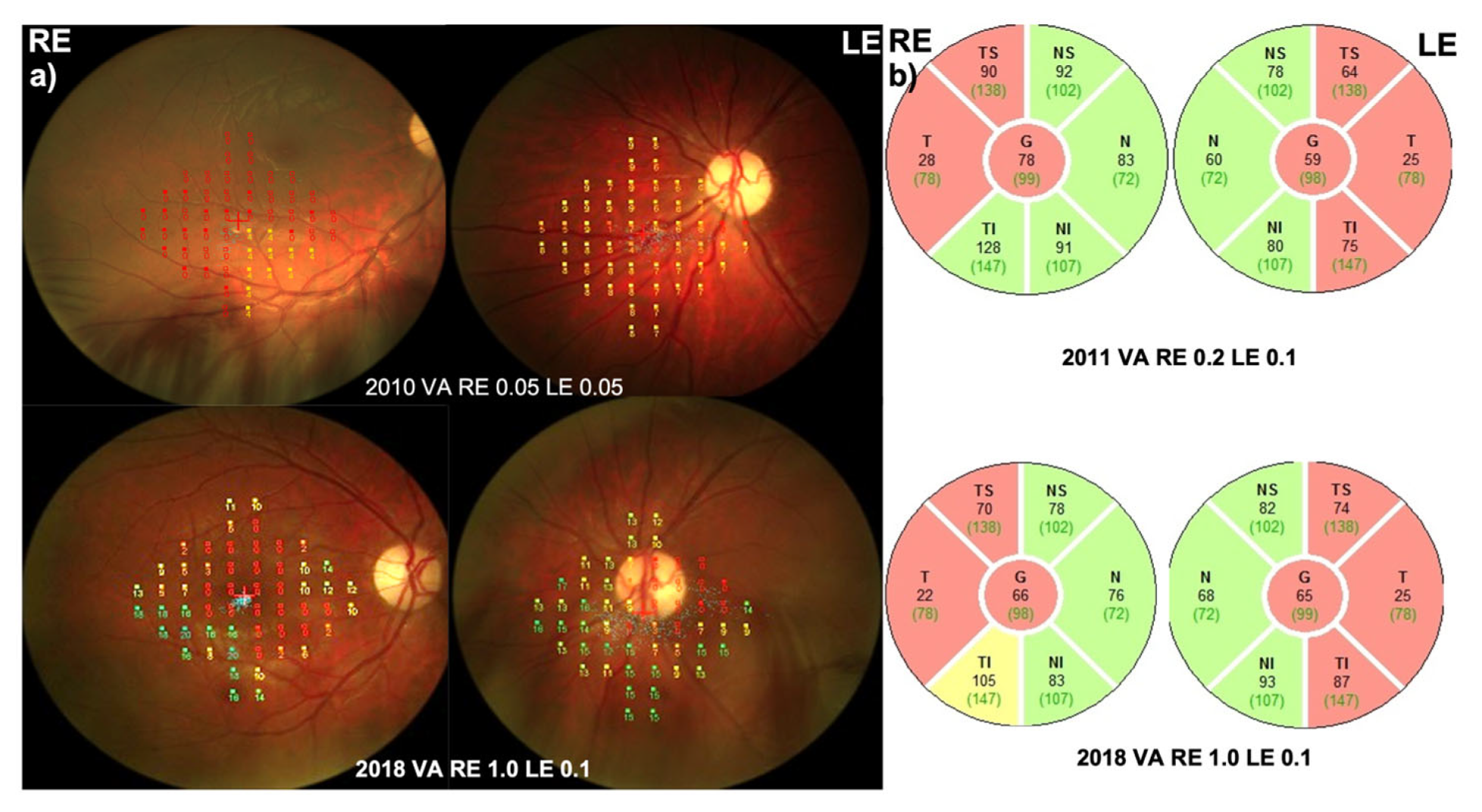Preprints 87262 g004