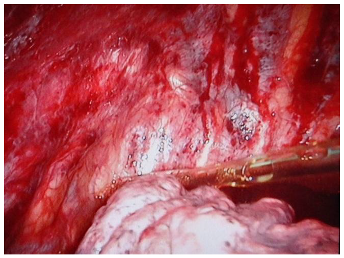 Preprints 153461 g003