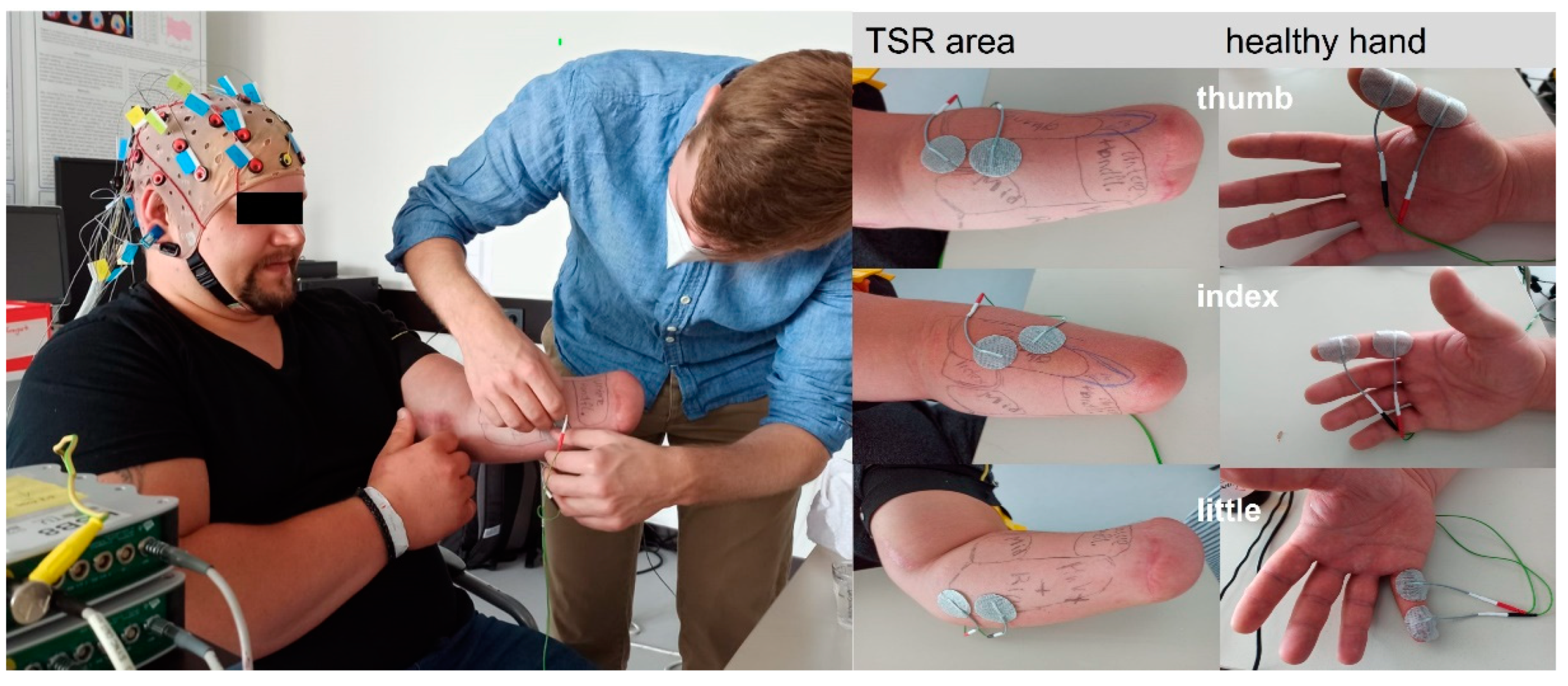 Preprints 143085 g003